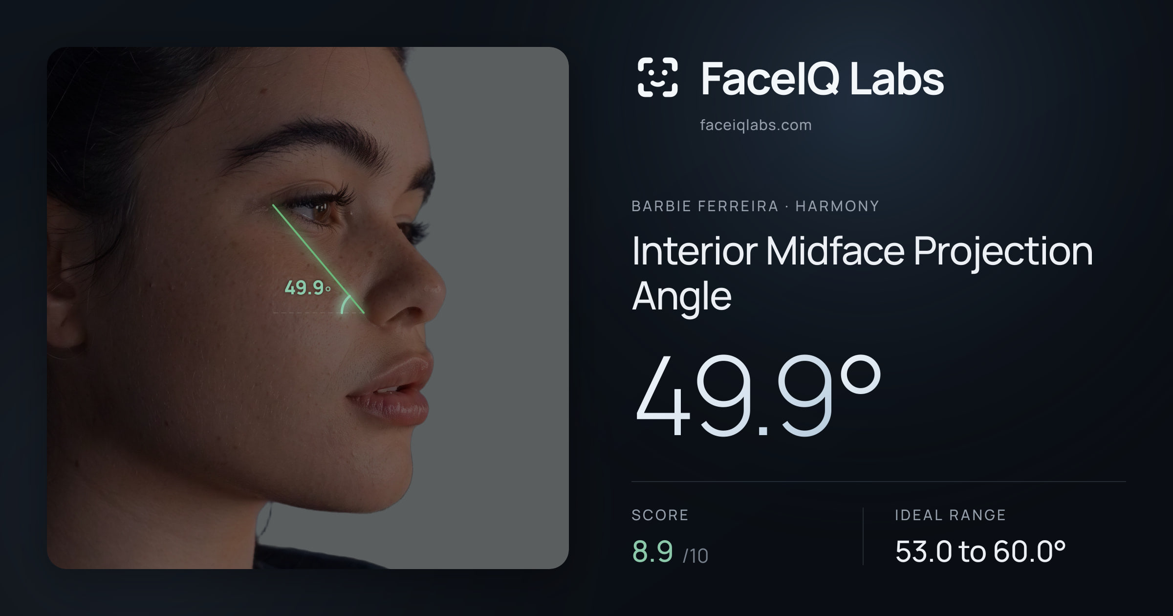 Barbie Ferreira Interior Midface Projection Angle: 49.9°, drawn on the photo