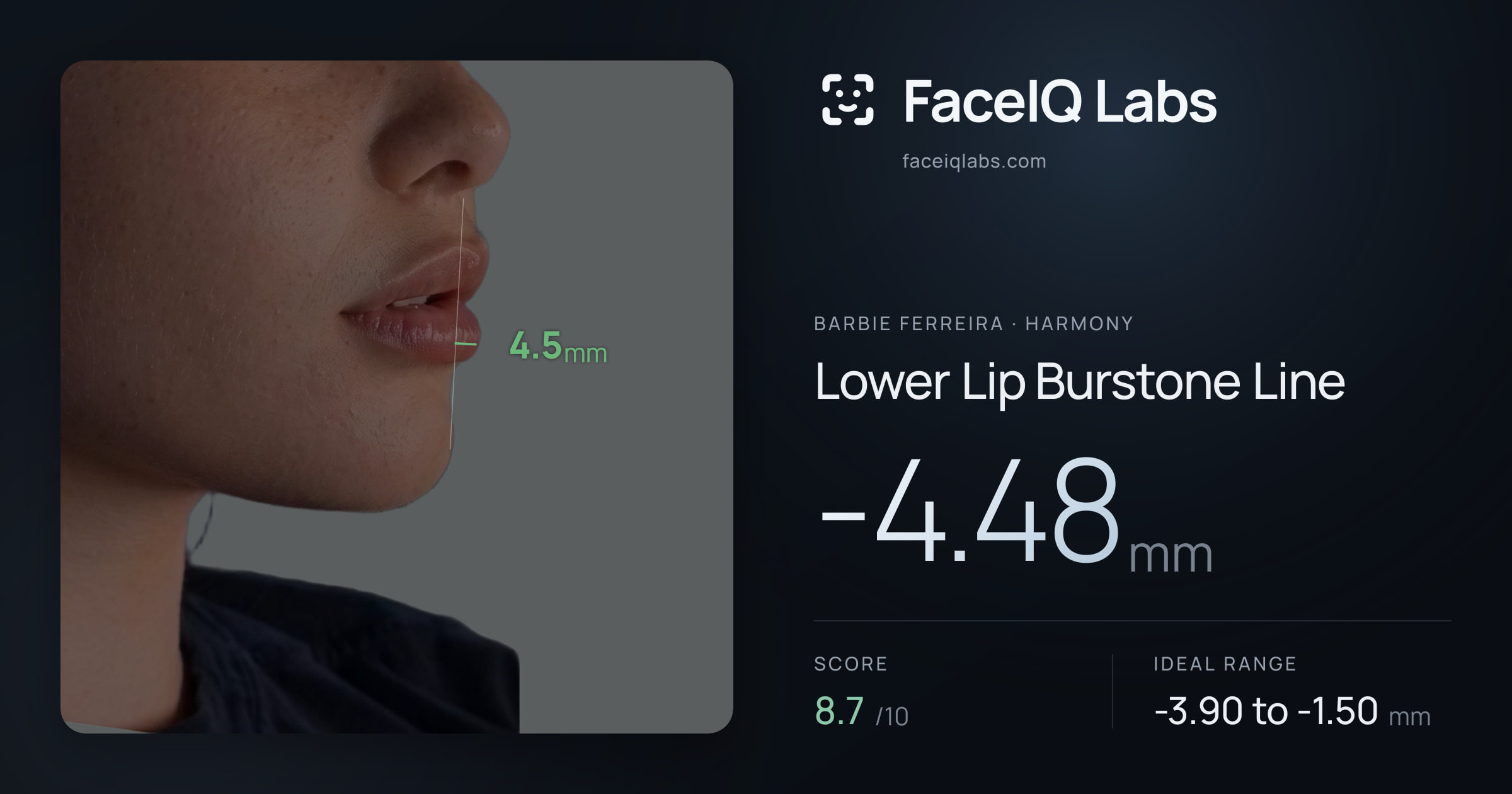Barbie Ferreira Lower Lip Burstone Line: -4.48mm, drawn on the photo
