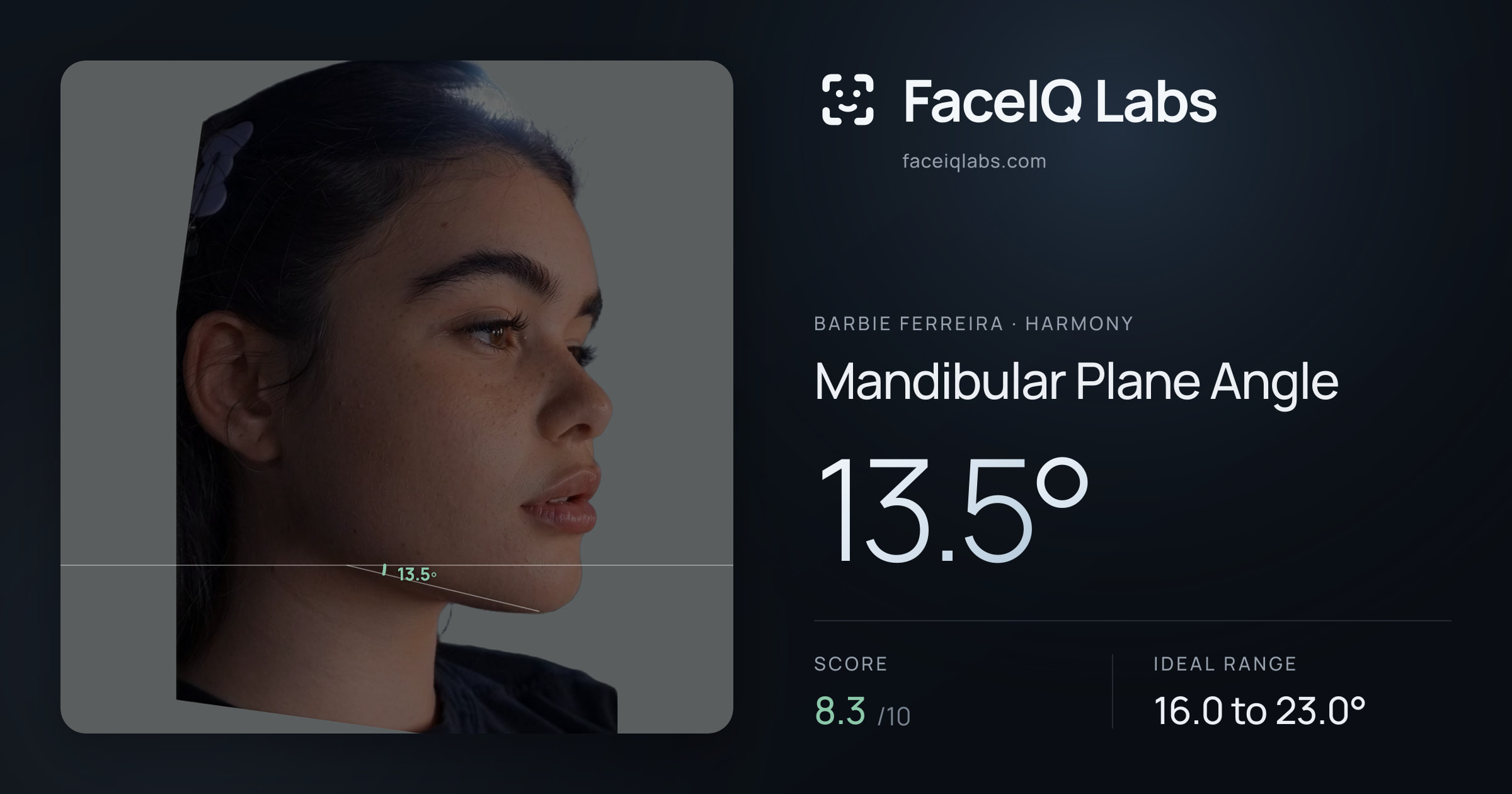 Barbie Ferreira Mandibular Plane Angle: 13.5°, drawn on the photo
