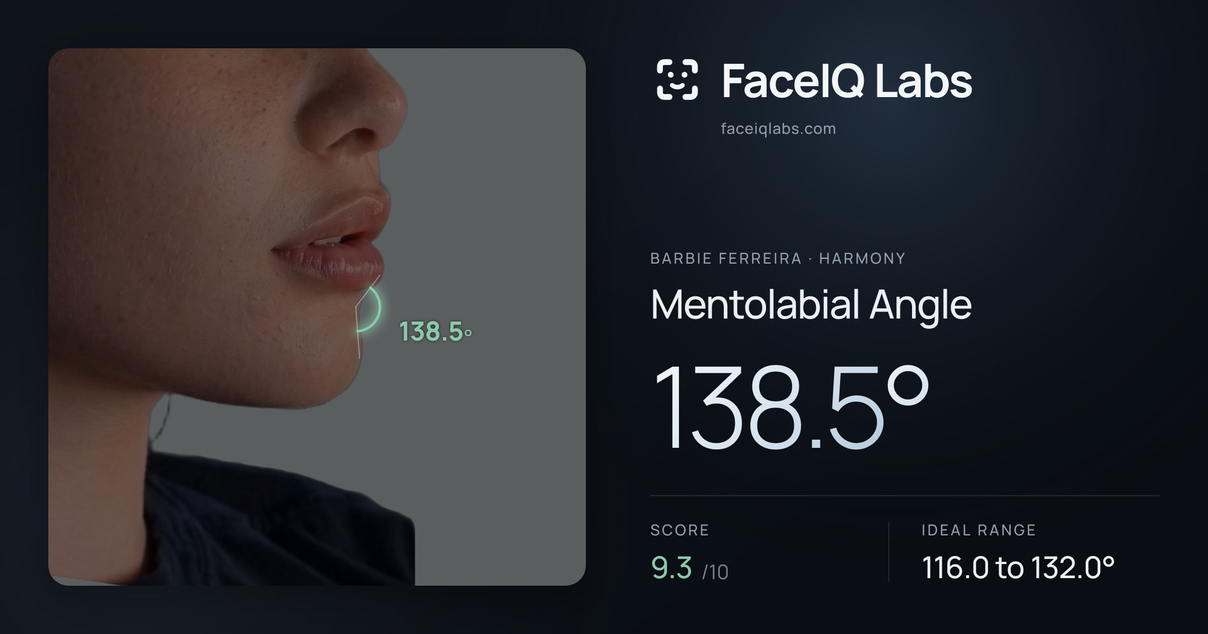 Barbie Ferreira Mentolabial Angle: 138.5°, drawn on the photo