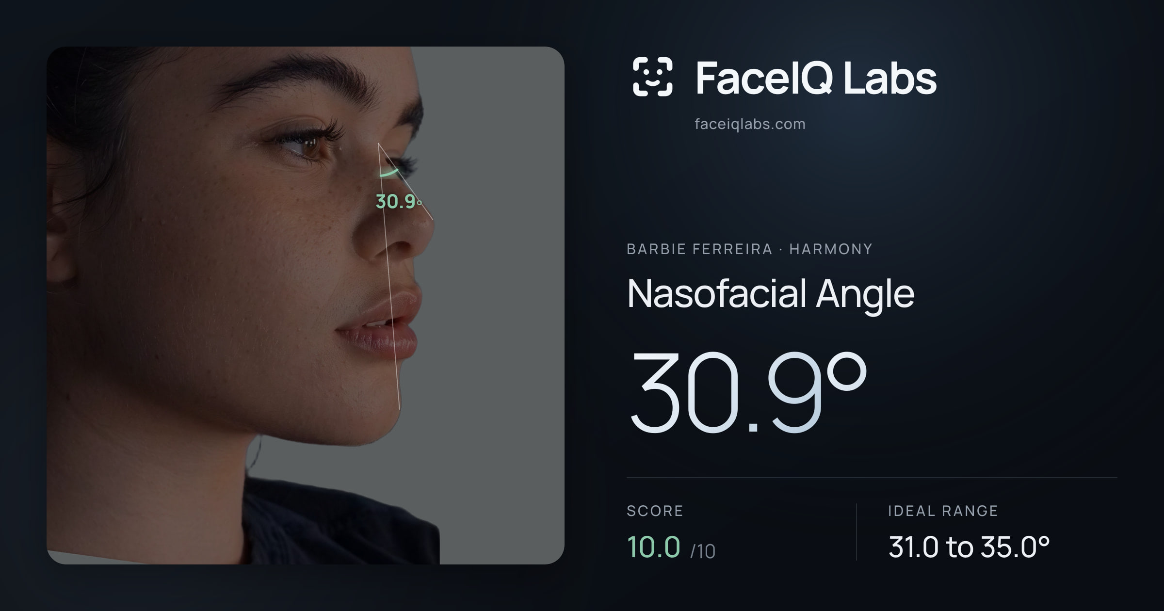 Barbie Ferreira Nasofacial Angle: 30.9°, drawn on the photo