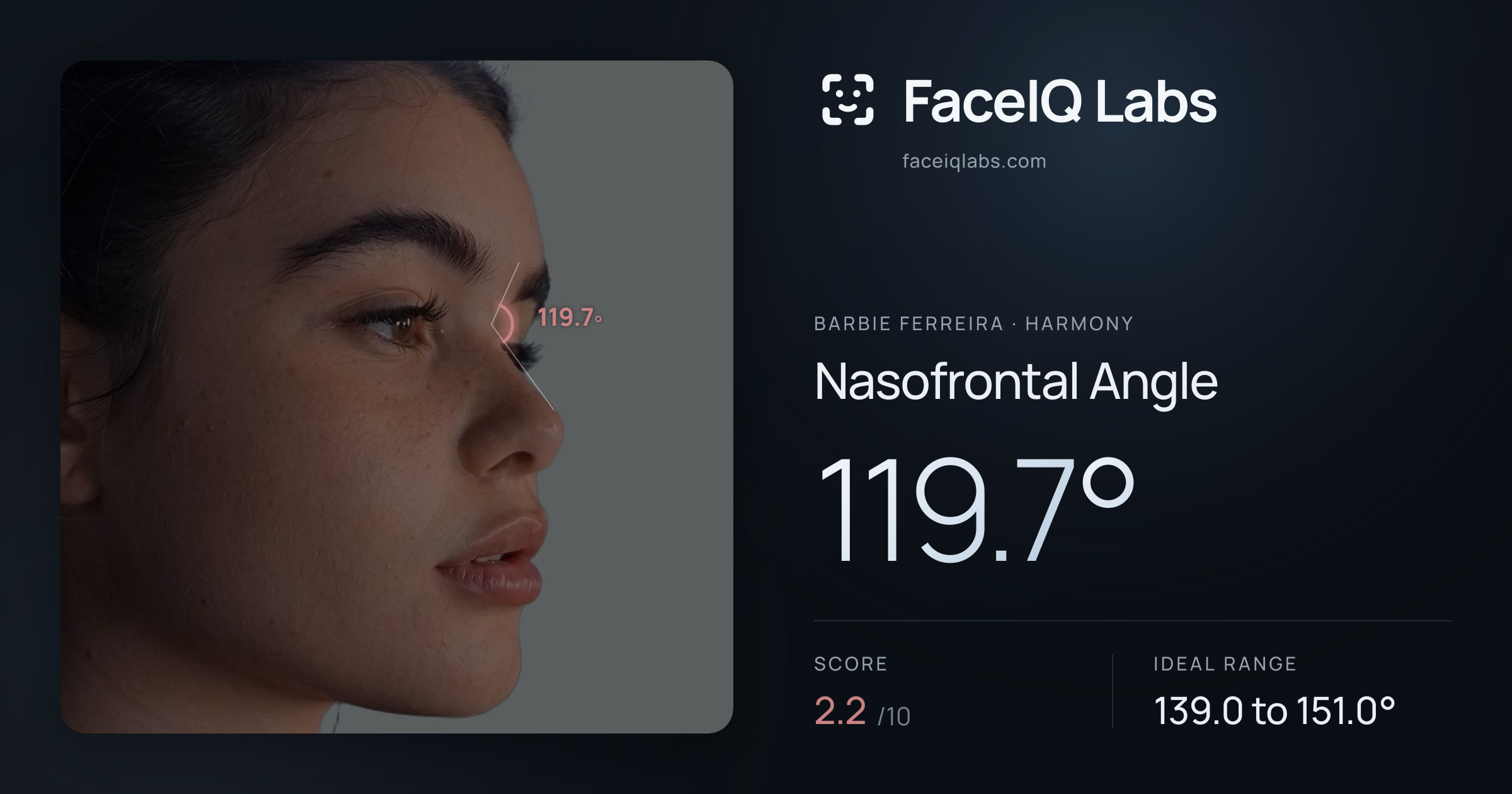 Barbie Ferreira Nasofrontal Angle: 119.7°, drawn on the photo