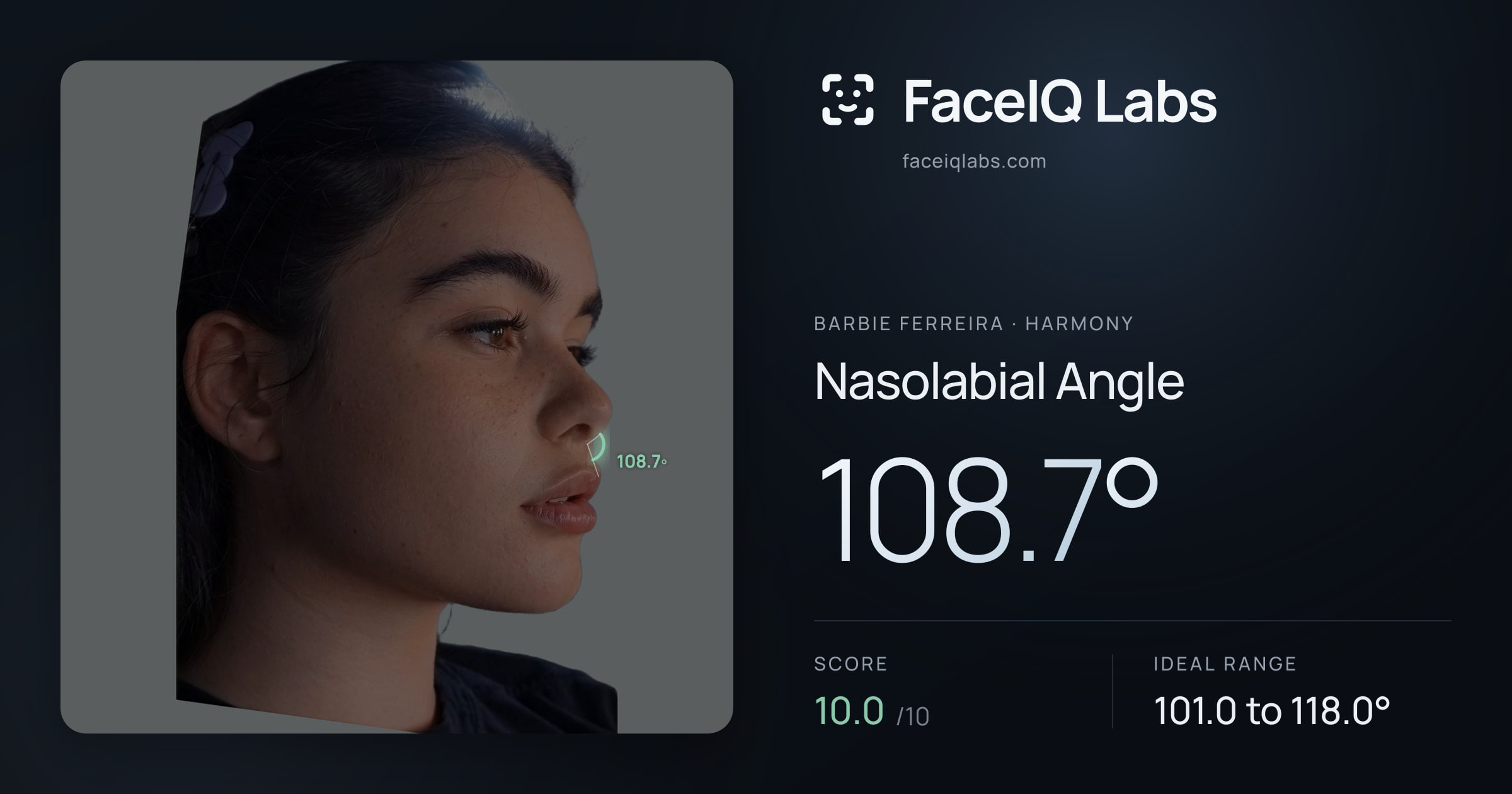 Barbie Ferreira Nasolabial Angle: 108.7°, drawn on the photo