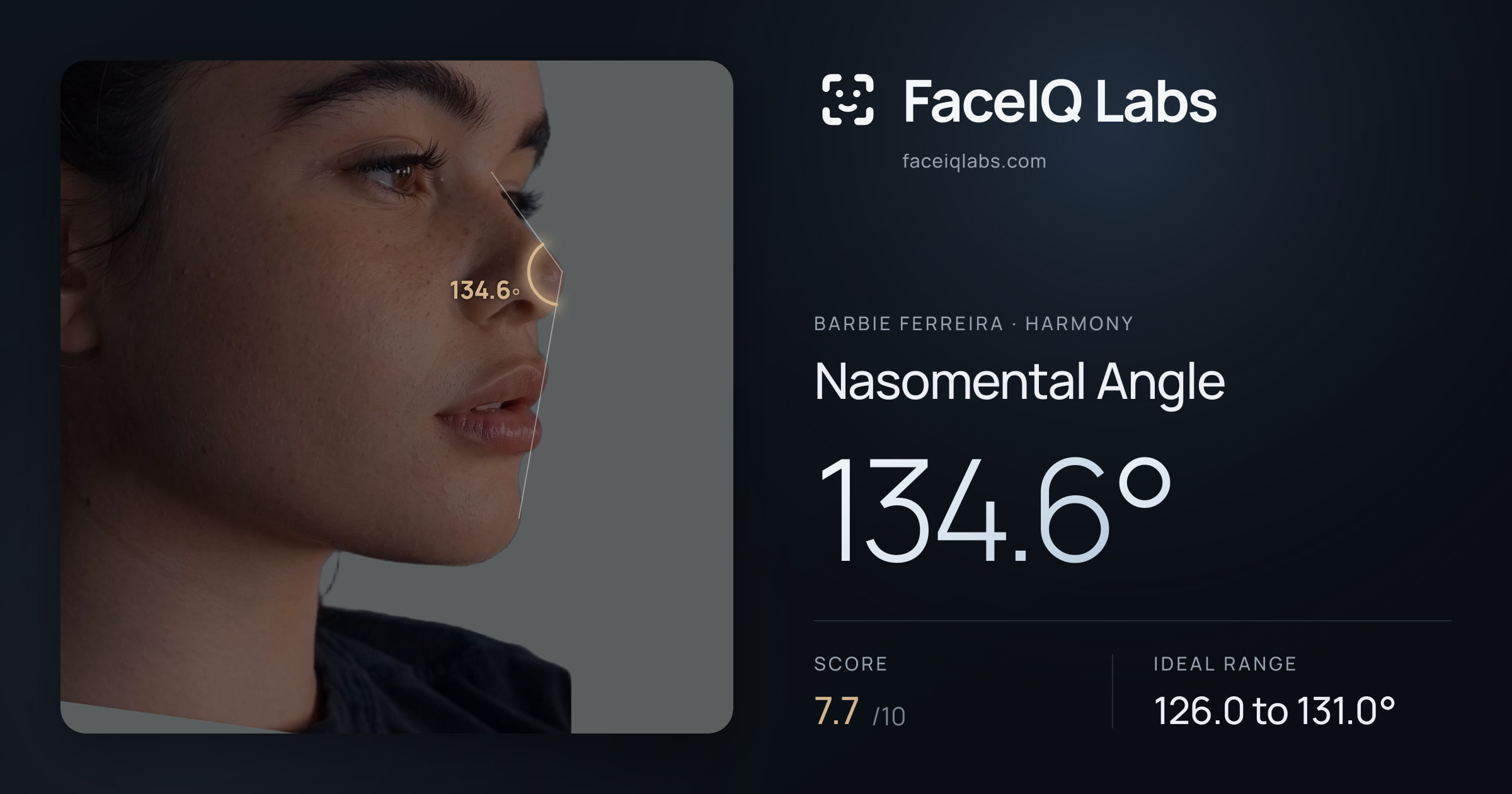 Barbie Ferreira Nasomental Angle: 134.6°, drawn on the photo