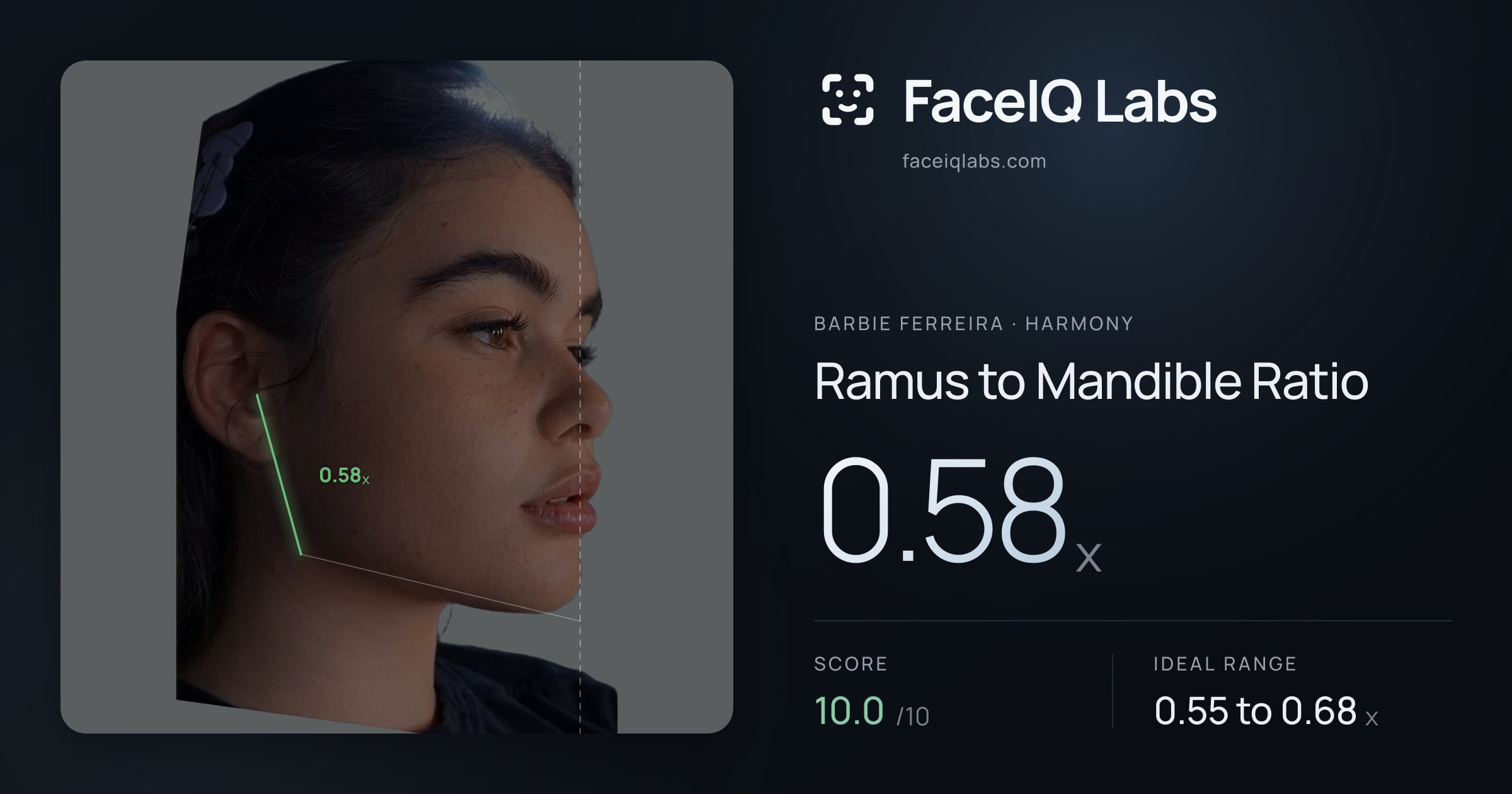 Barbie Ferreira Ramus to Mandible Ratio: 0.58x, drawn on the photo