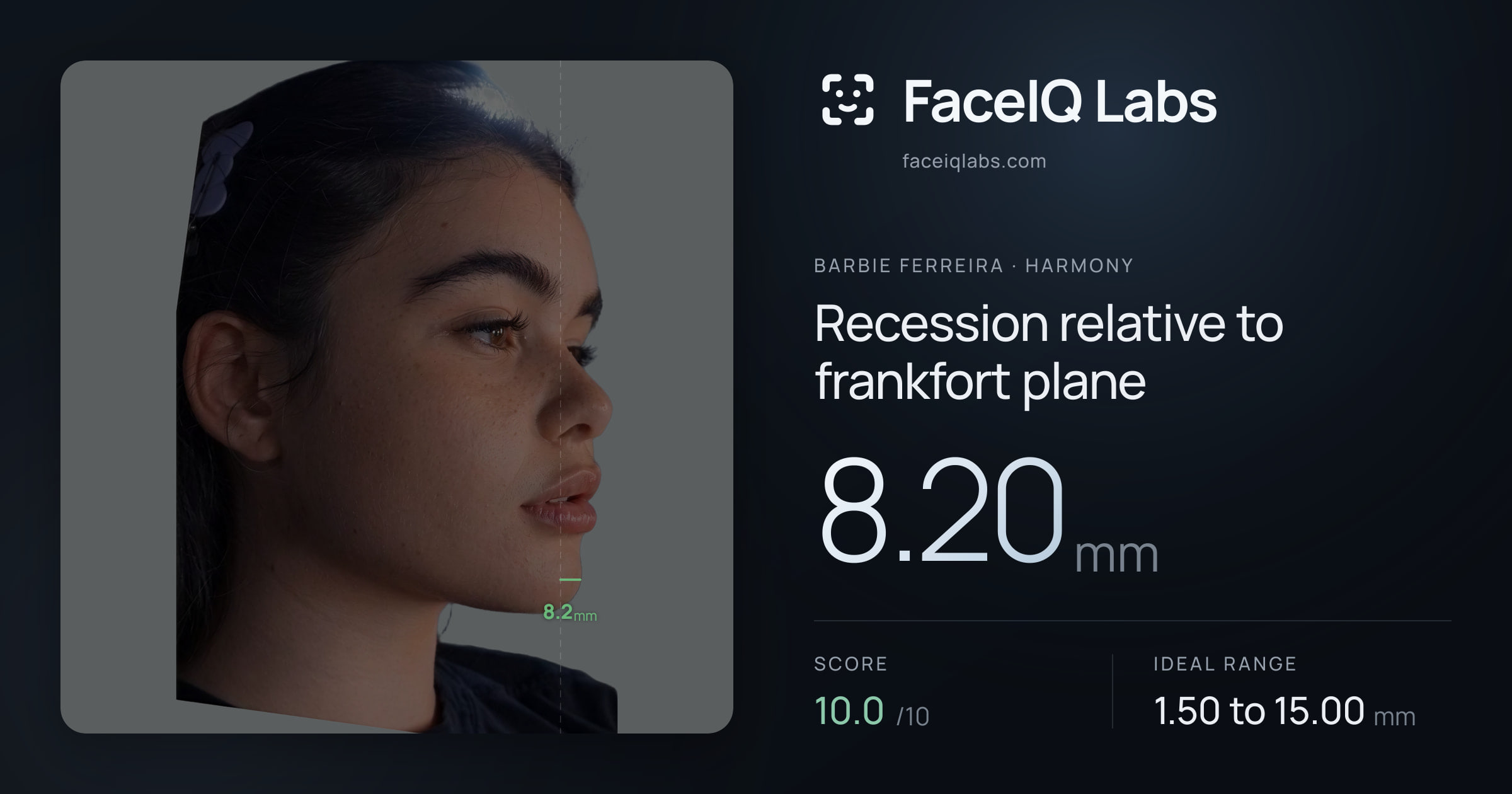 Barbie Ferreira Recession relative to frankfort plane: 8.20mm, drawn on the photo