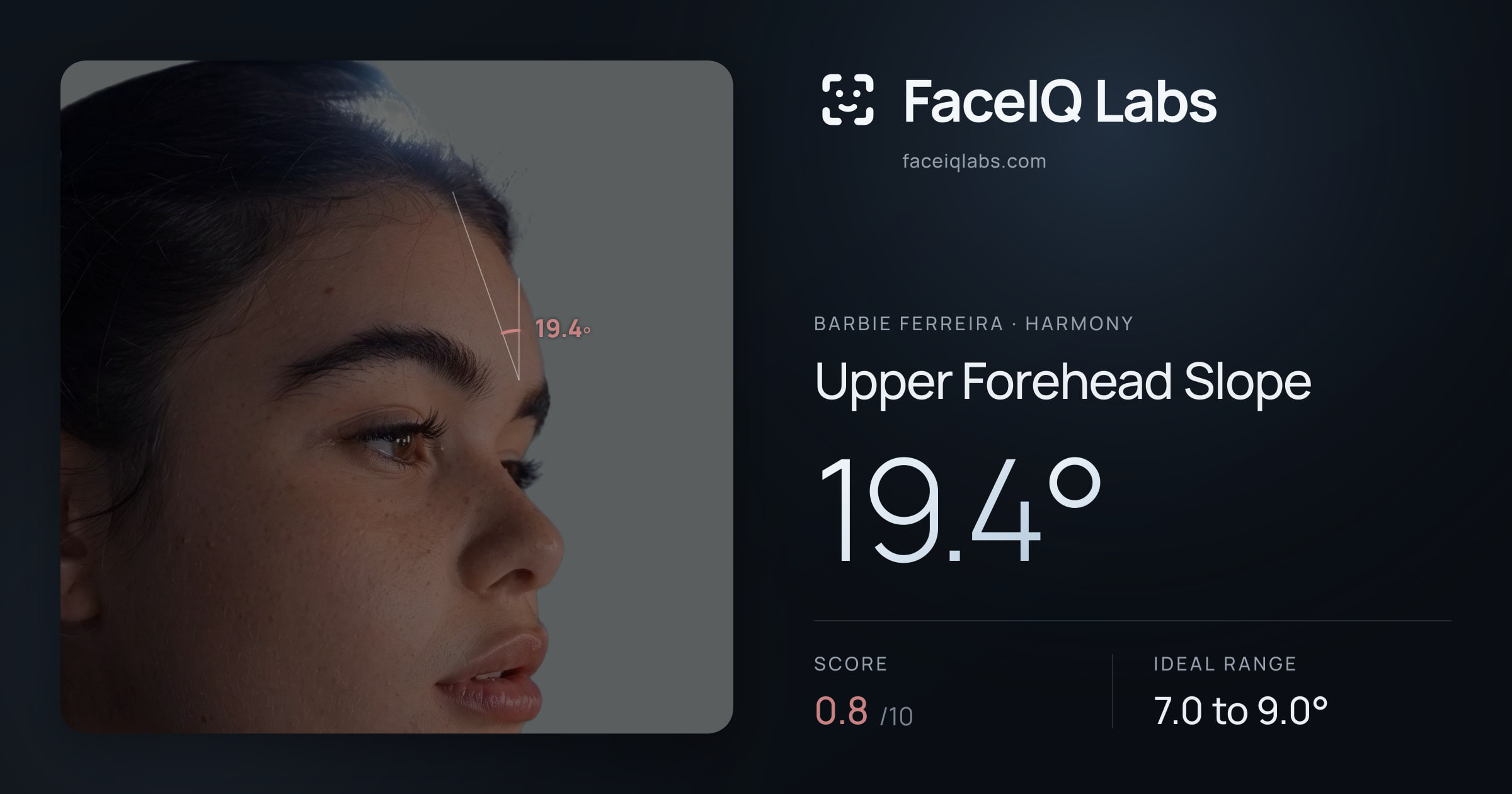 Barbie Ferreira Upper Forehead Slope: 19.4°, drawn on the photo
