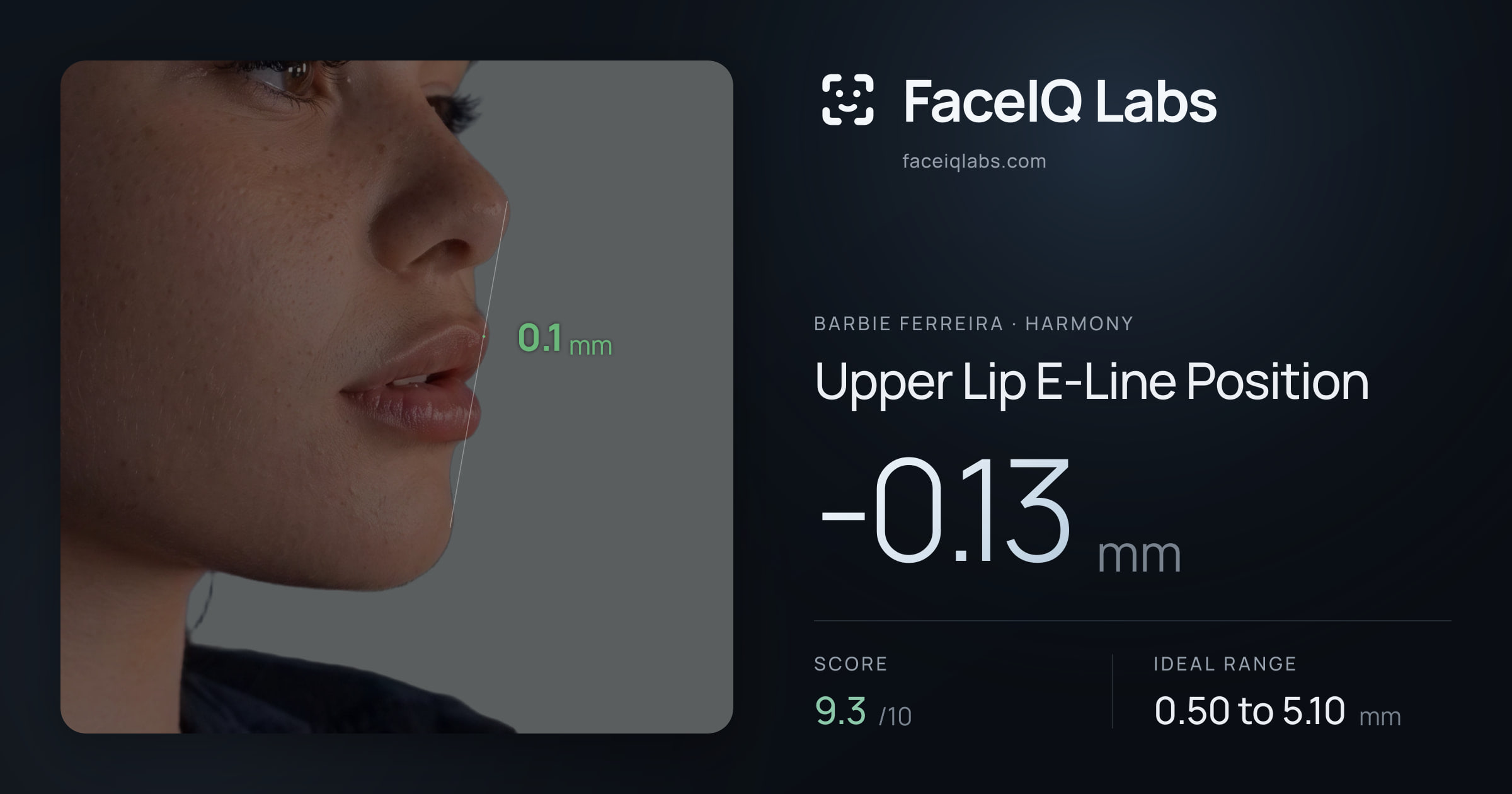Barbie Ferreira Upper Lip E-Line Position: -0.13mm, drawn on the photo