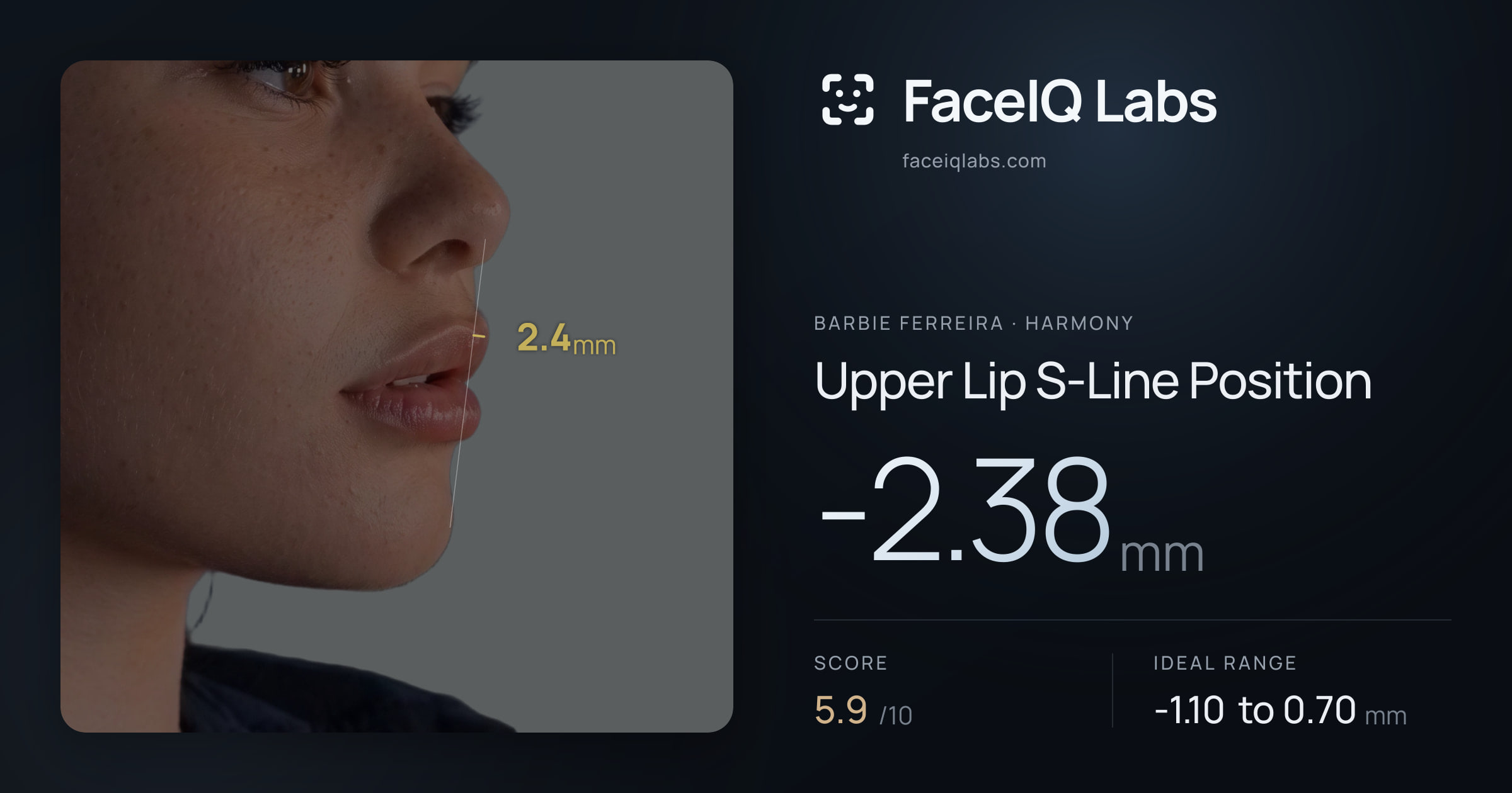Barbie Ferreira Upper Lip S-Line Position: -2.38mm, drawn on the photo