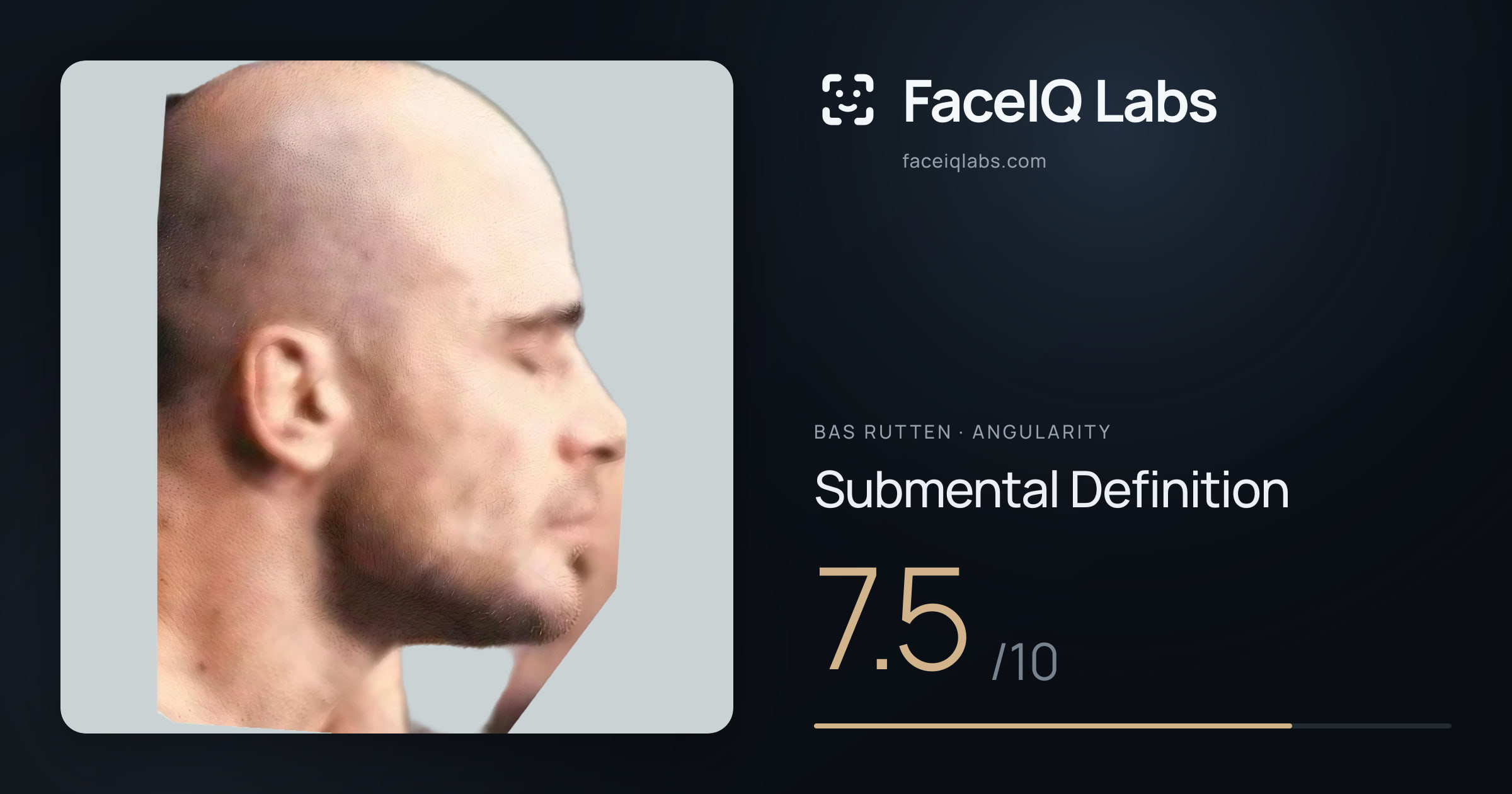Bas Rutten Submental Definition: 7.5/10, drawn on the photo