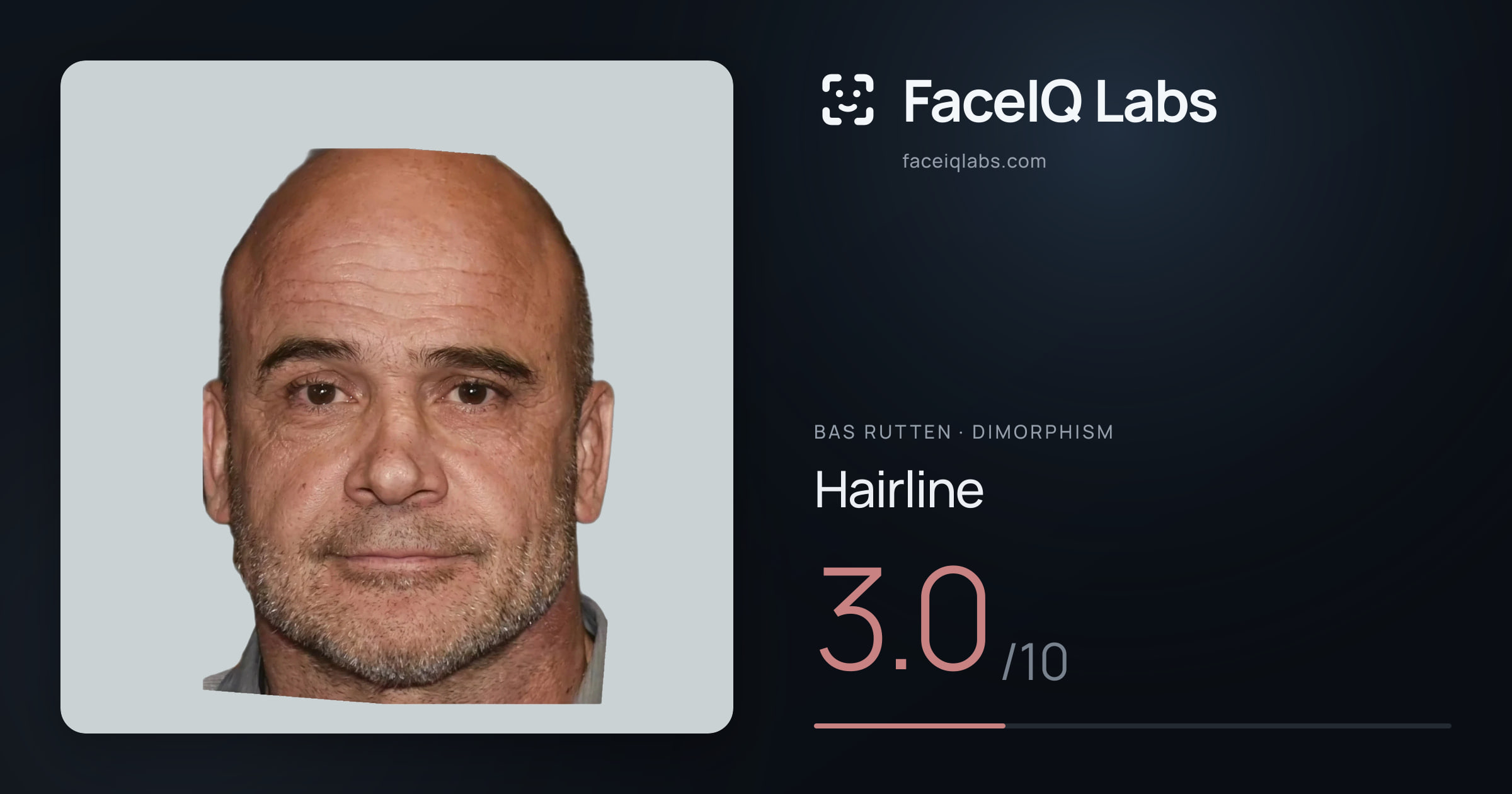 Bas Rutten Hairline: 3.0/10, drawn on the photo