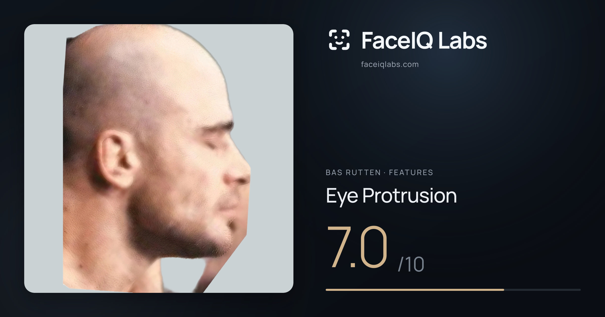 Bas Rutten Eye Protrusion: 7.0/10, drawn on the photo