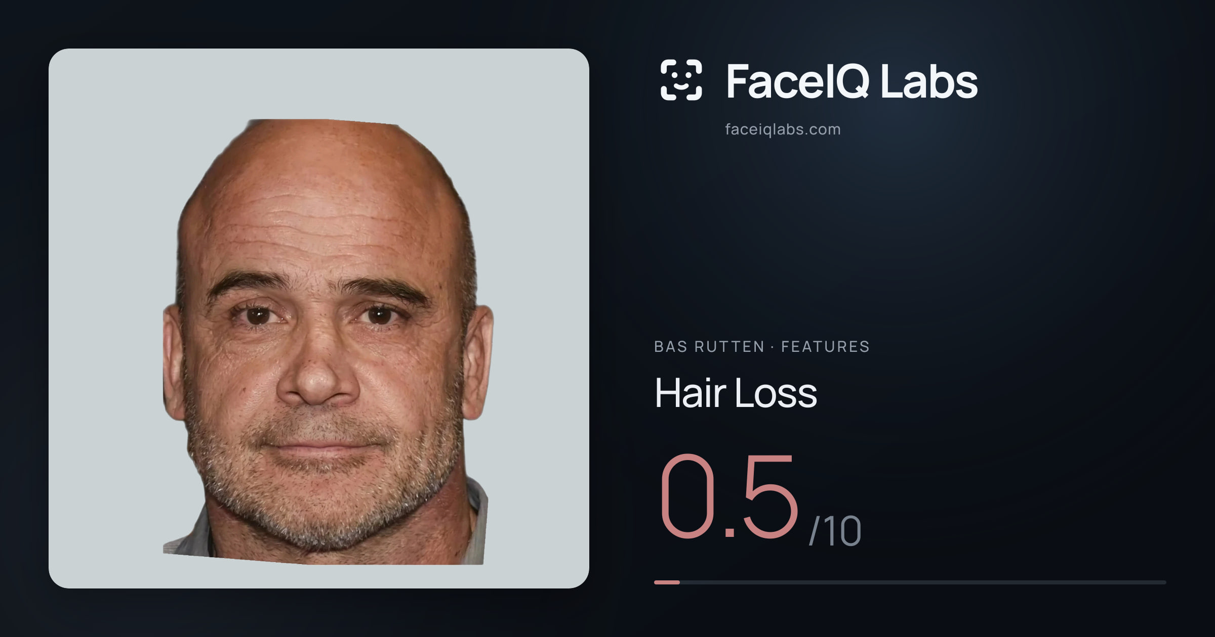 Bas Rutten Hair Loss: 0.5/10, drawn on the photo