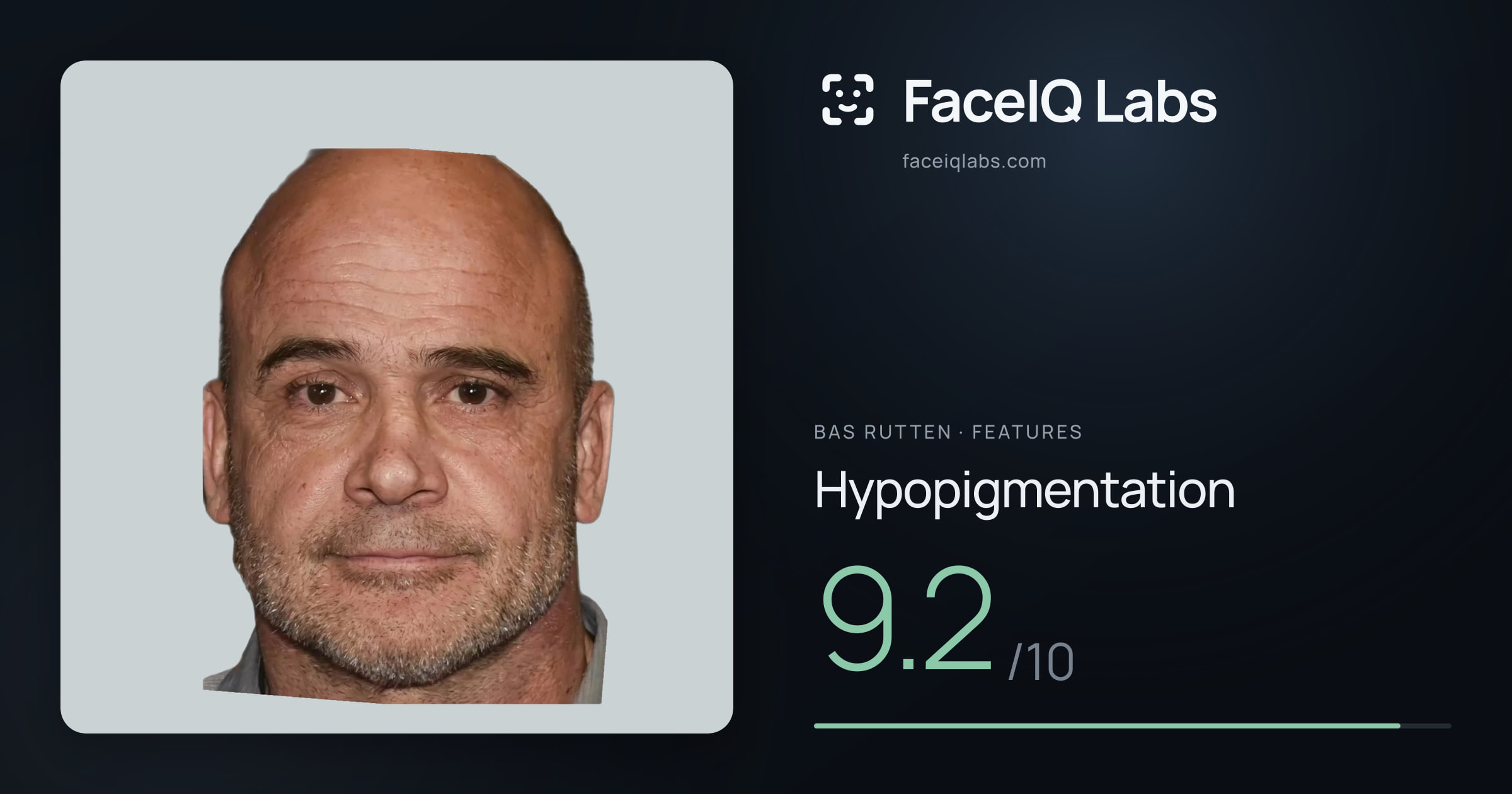 Bas Rutten Hypopigmentation: 9.2/10, drawn on the photo