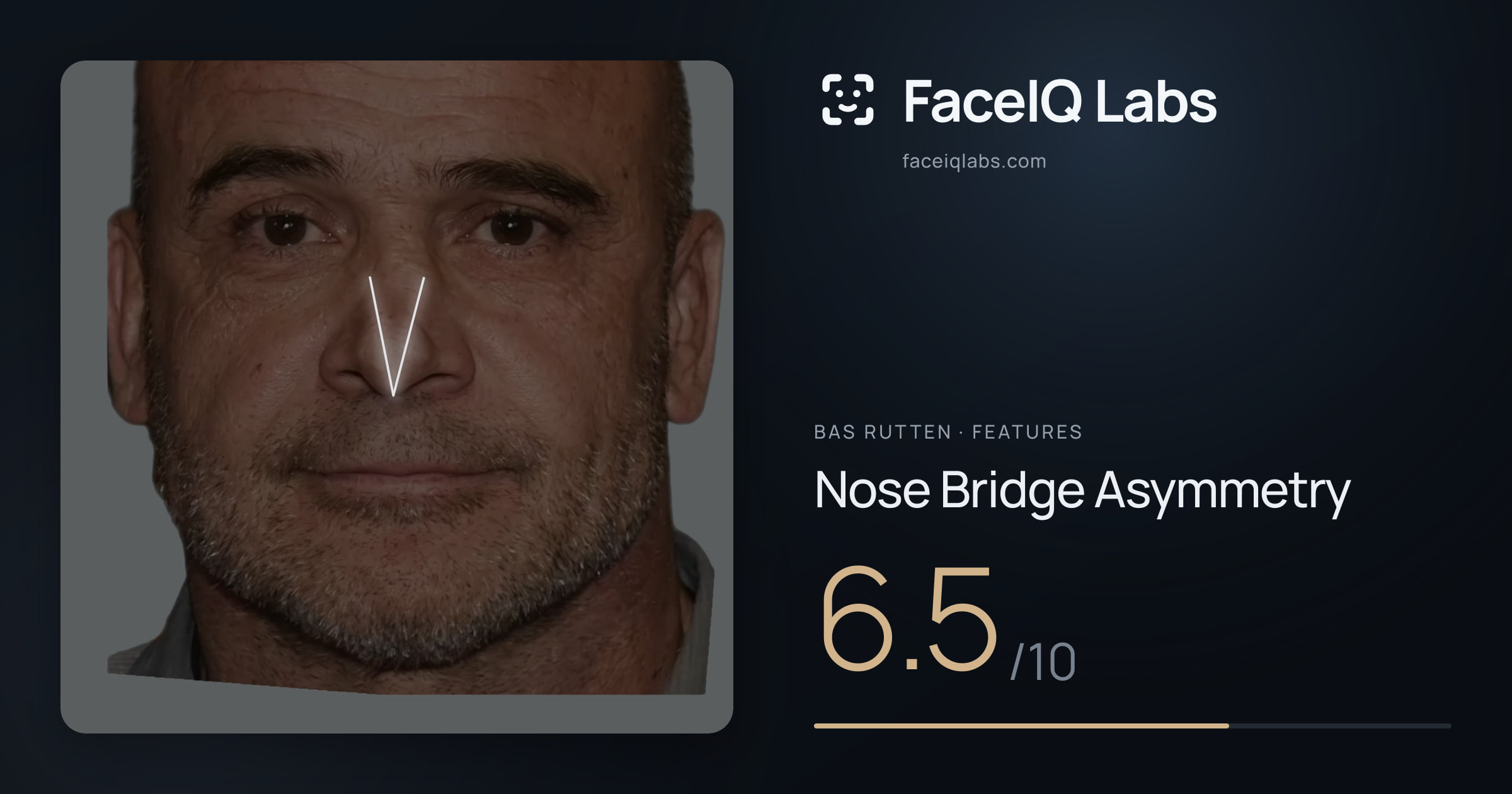 Bas Rutten Nose Bridge Asymmetry: 6.5/10, drawn on the photo