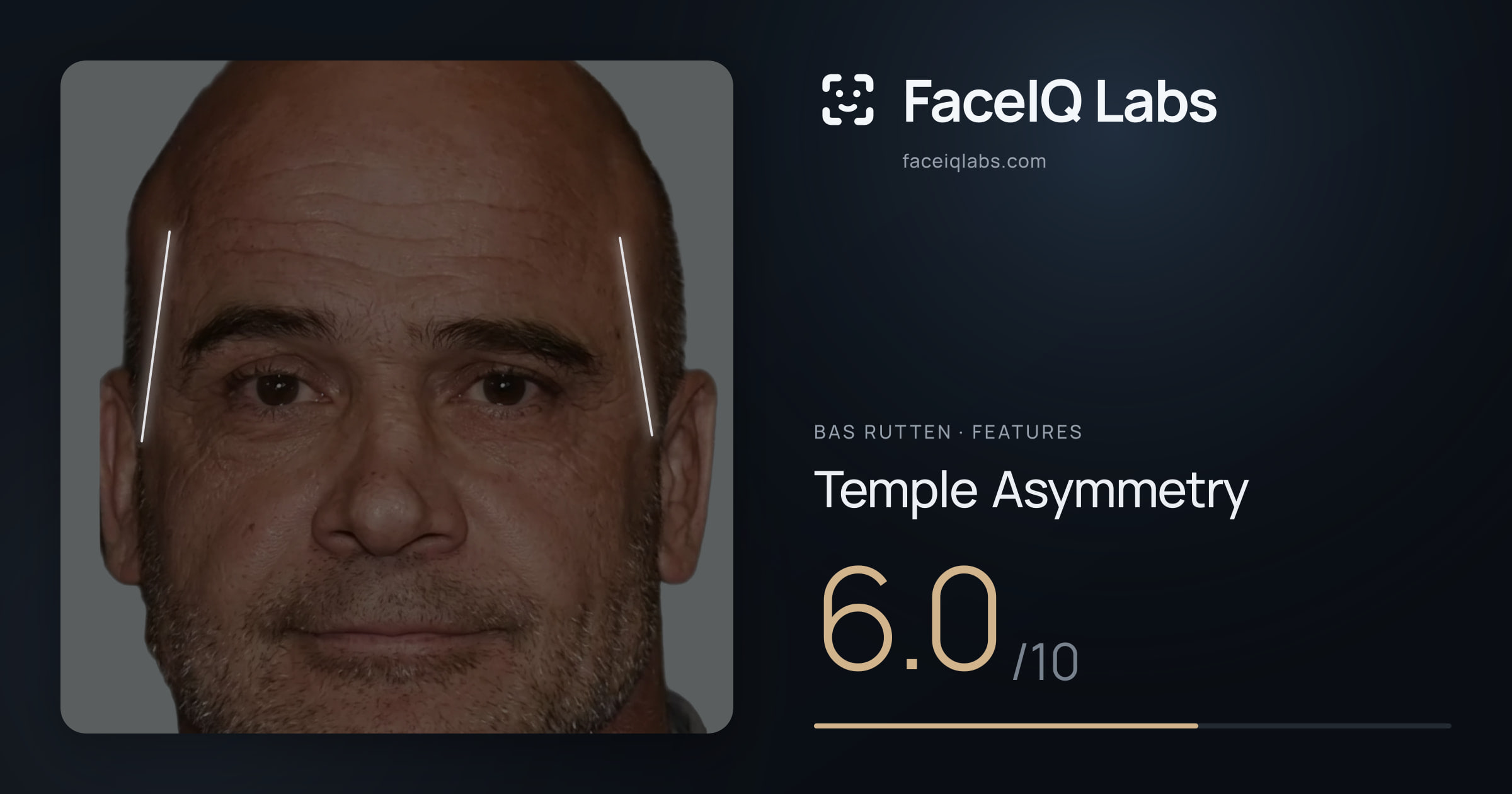Bas Rutten Temple Asymmetry: 6.0/10, drawn on the photo