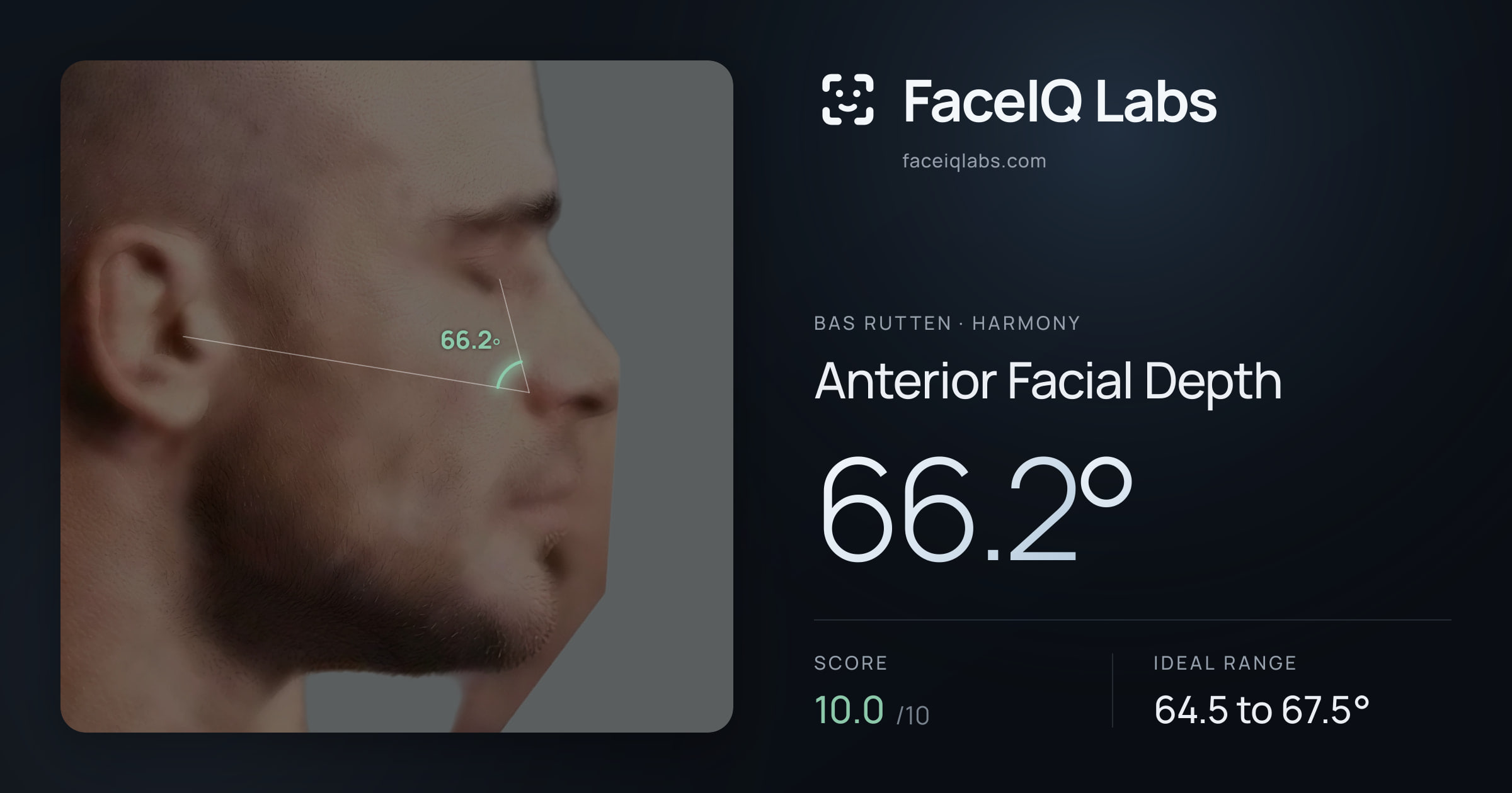 Bas Rutten Anterior Facial Depth: 66.2°, drawn on the photo