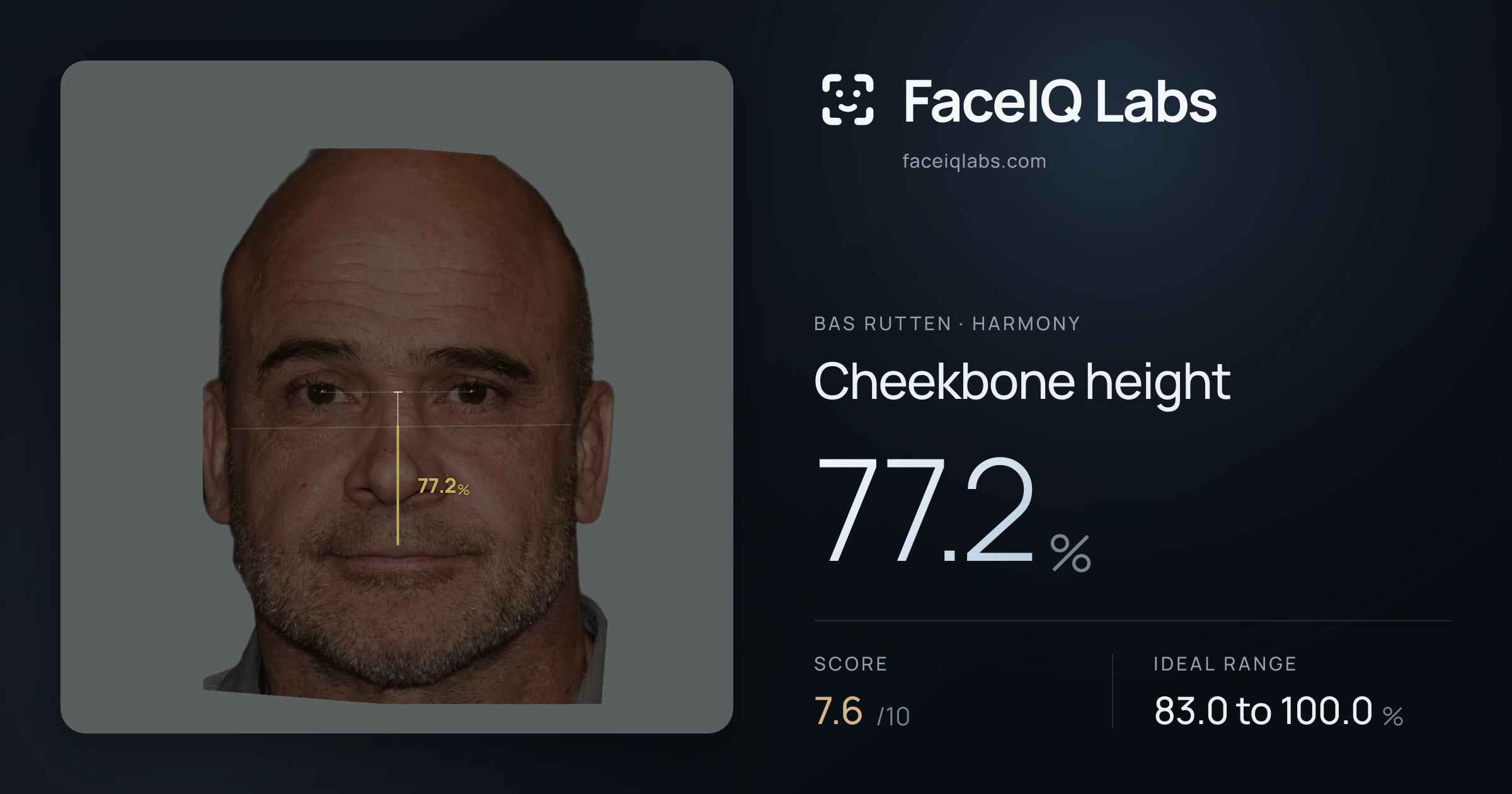 Bas Rutten Cheekbone height: 77.2%, drawn on the photo