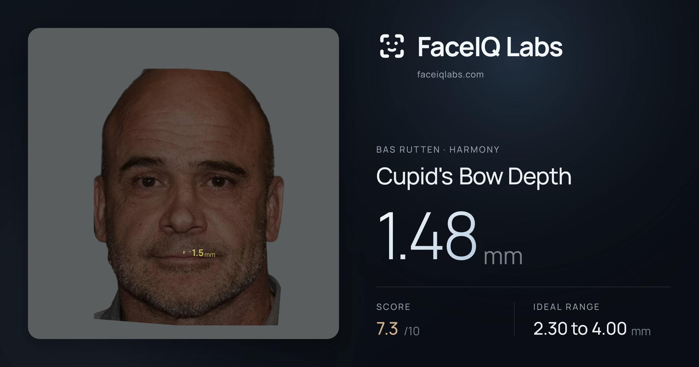 Bas Rutten Cupid's Bow Depth: 1.48mm, drawn on the photo