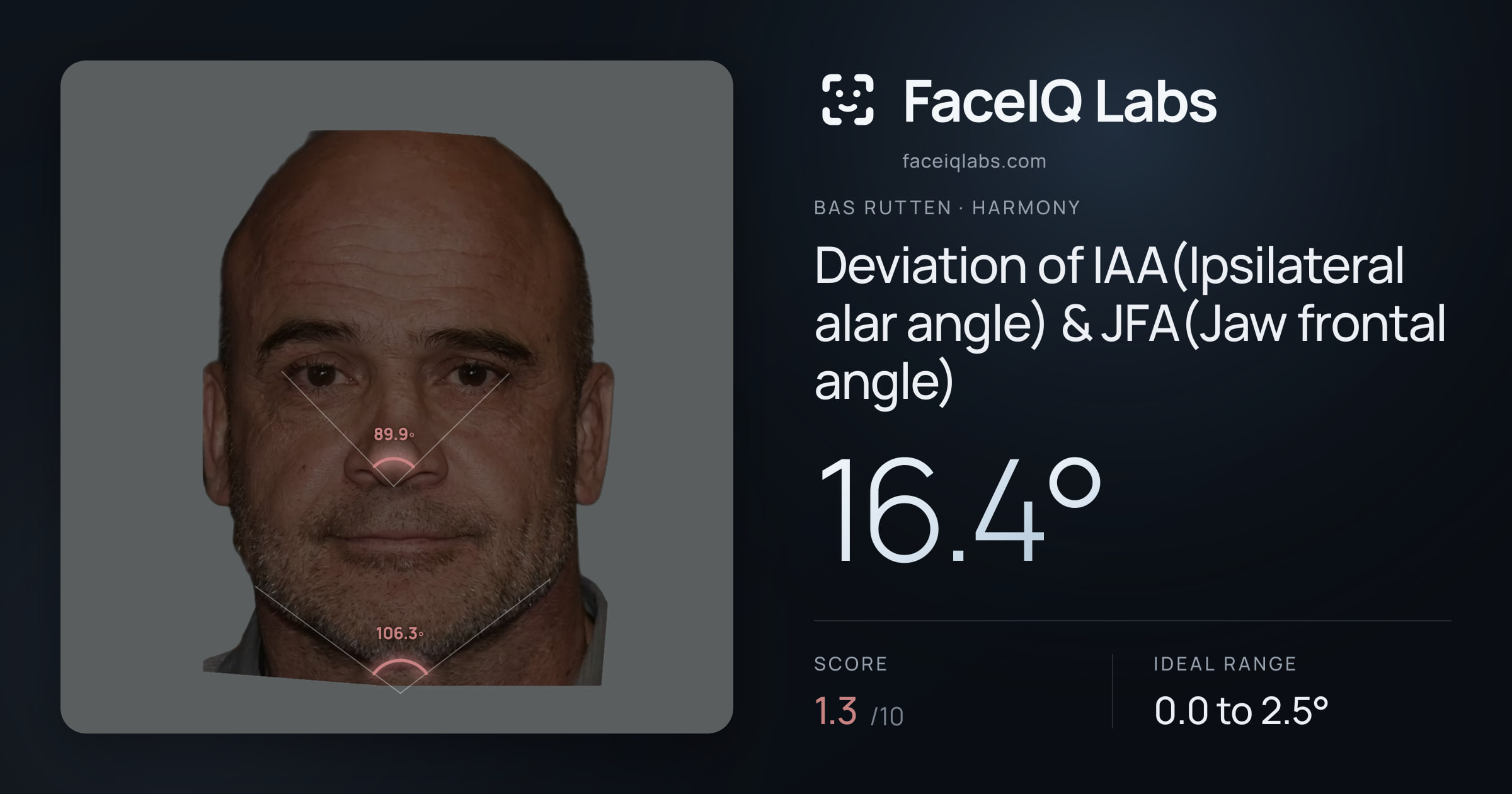 Bas Rutten Deviation of IAA(Ipsilateral alar angle) & JFA(Jaw frontal angle): 16.4°, drawn on the photo
