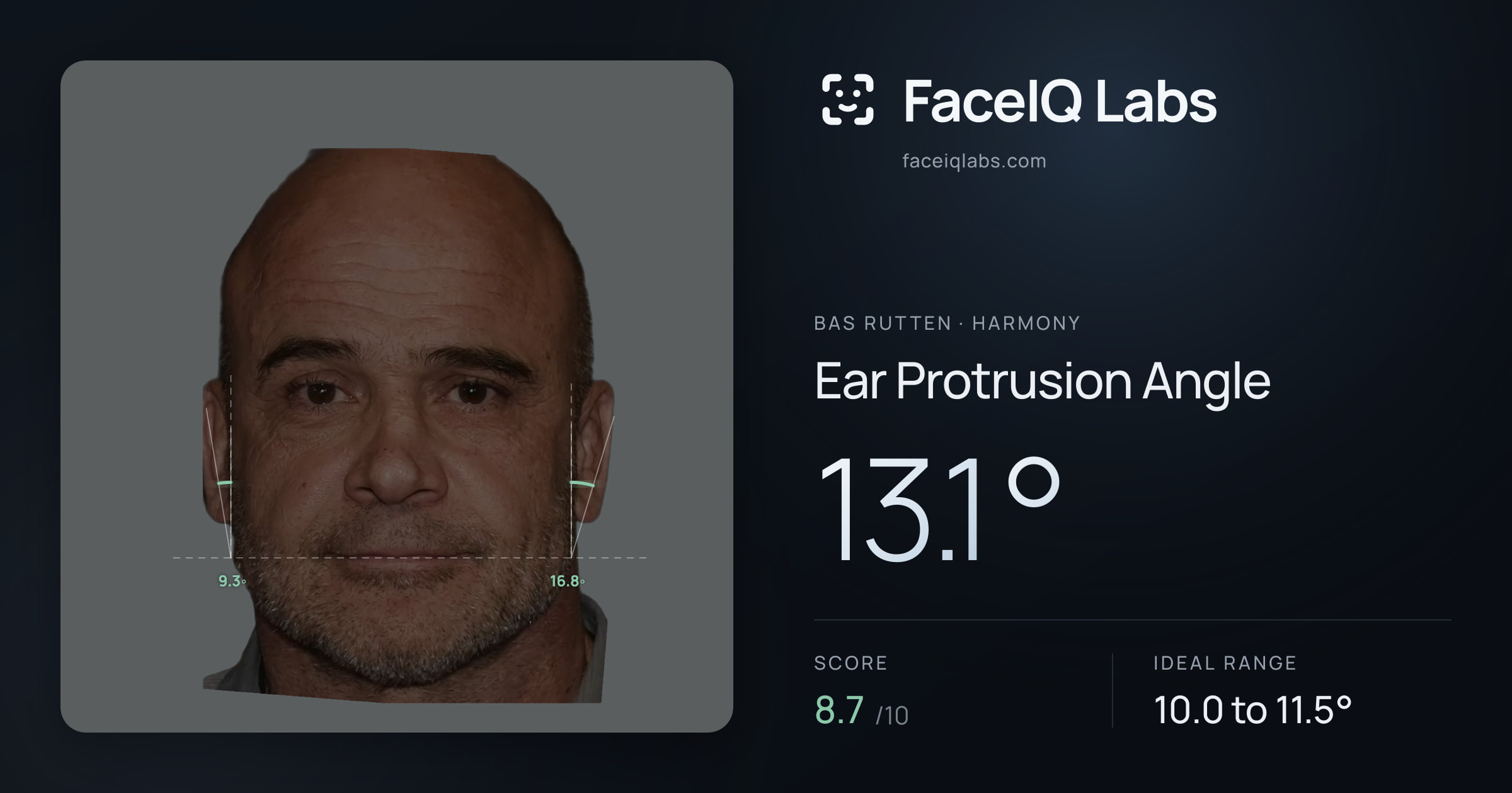 Bas Rutten Ear Protrusion Angle: 13.1°, drawn on the photo