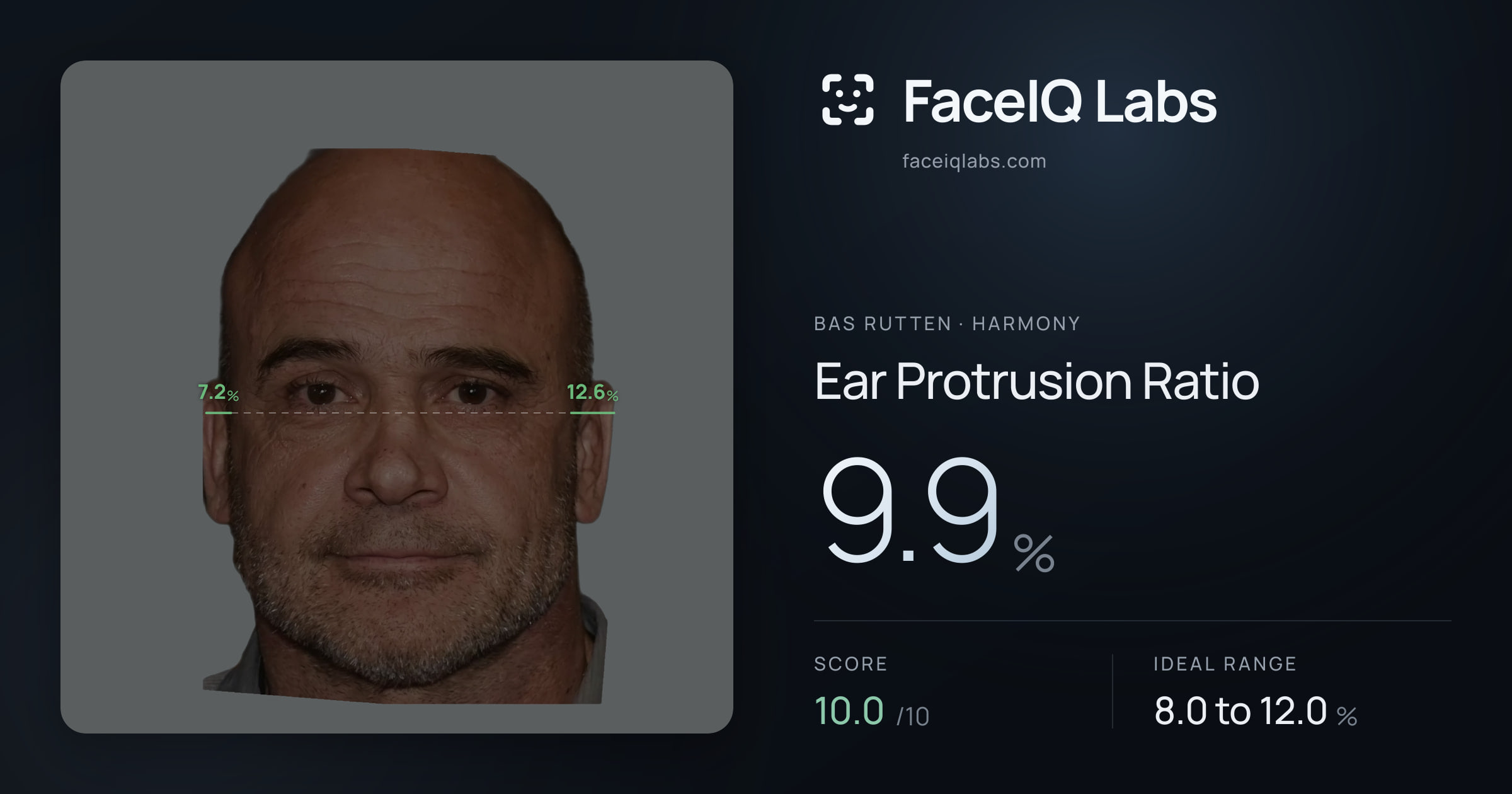 Bas Rutten Ear Protrusion Ratio: 9.9%, drawn on the photo