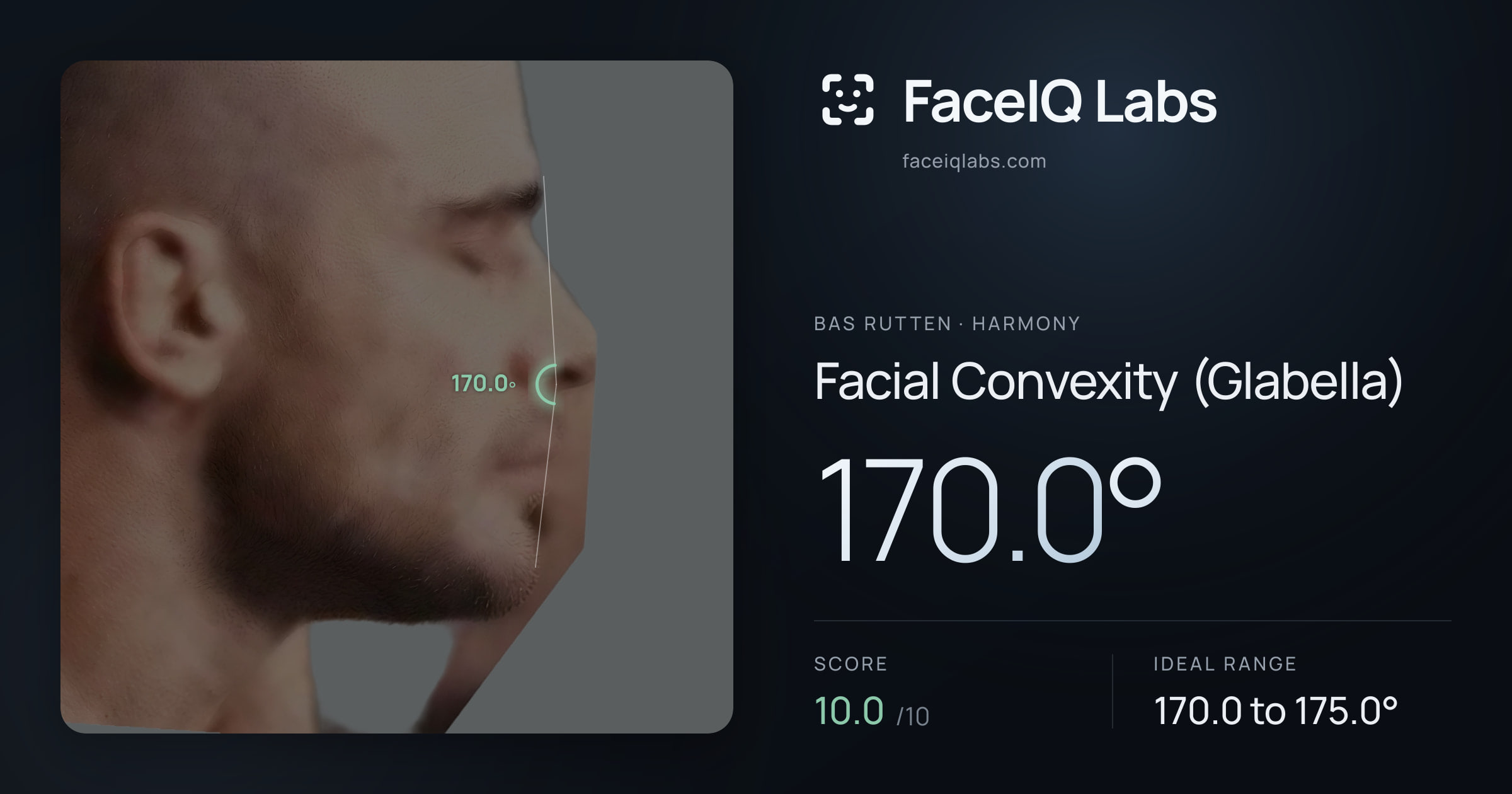 Bas Rutten Facial Convexity (Glabella): 170.0°, drawn on the photo