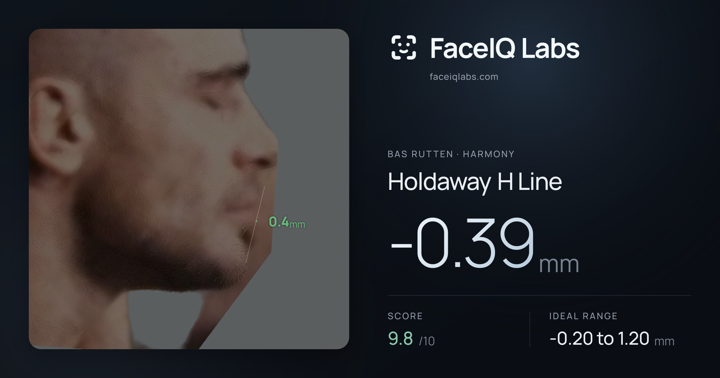 Bas Rutten Holdaway H Line: -0.39mm, drawn on the photo
