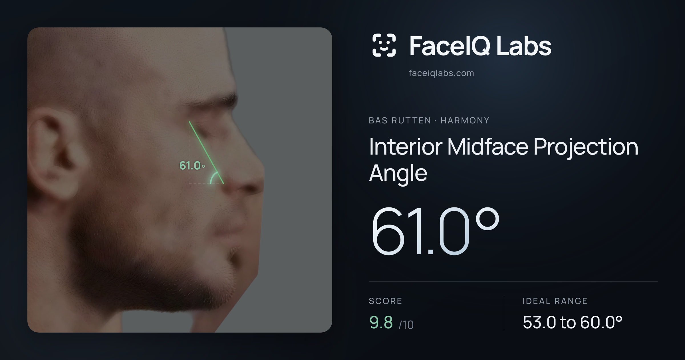 Bas Rutten Interior Midface Projection Angle: 61.0°, drawn on the photo