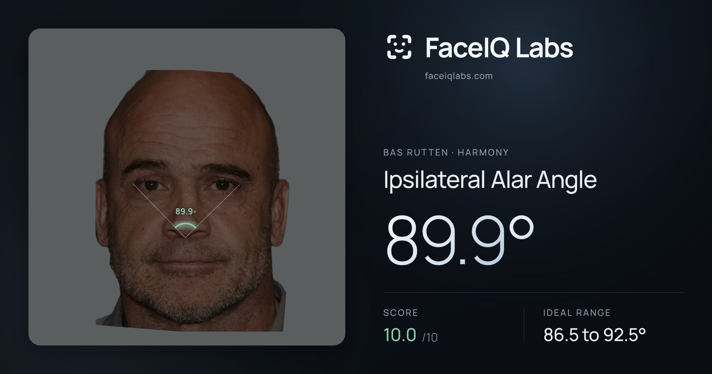 Bas Rutten Ipsilateral Alar Angle: 89.9°, drawn on the photo