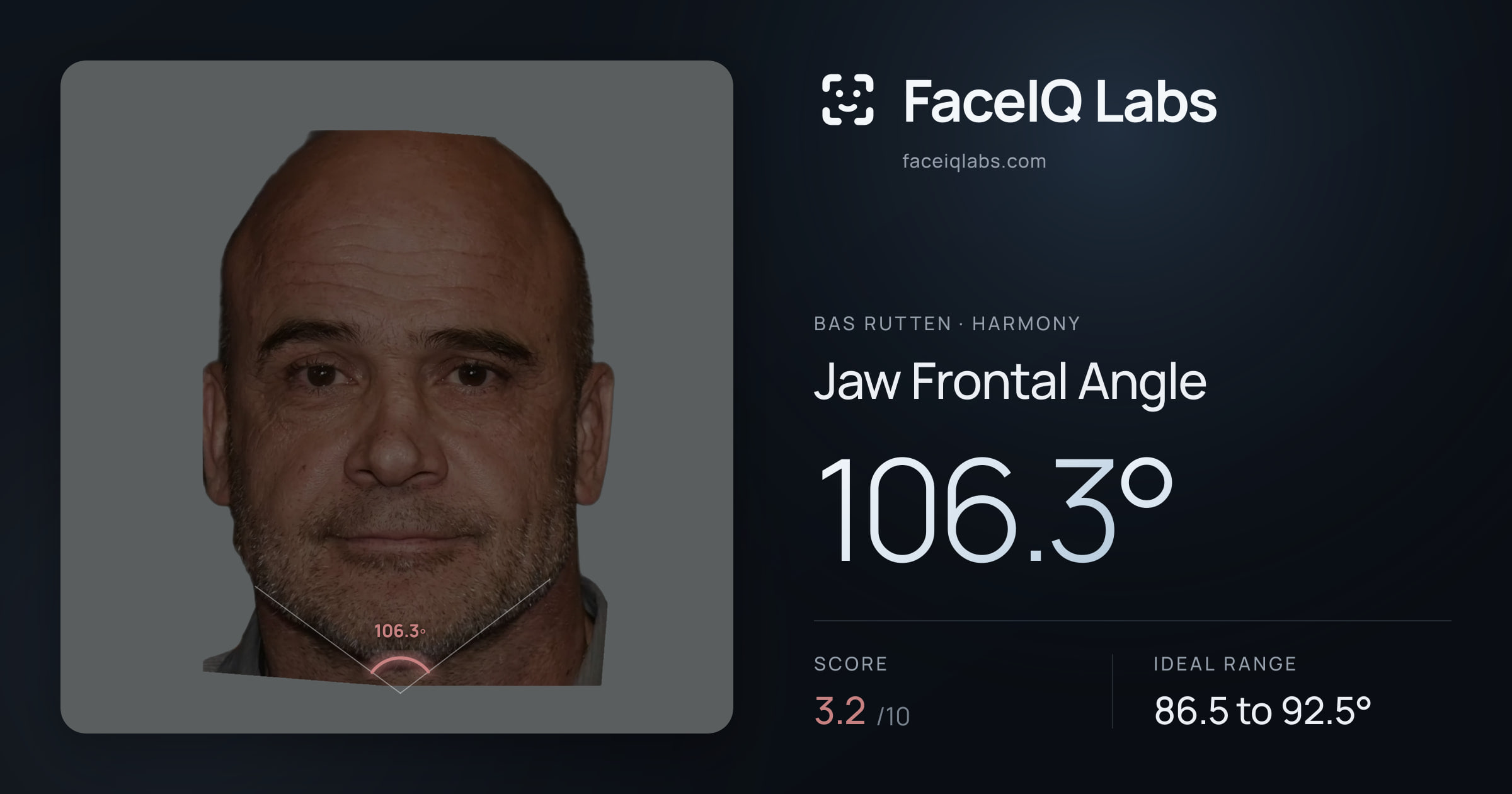 Bas Rutten Jaw Frontal Angle: 106.3°, drawn on the photo