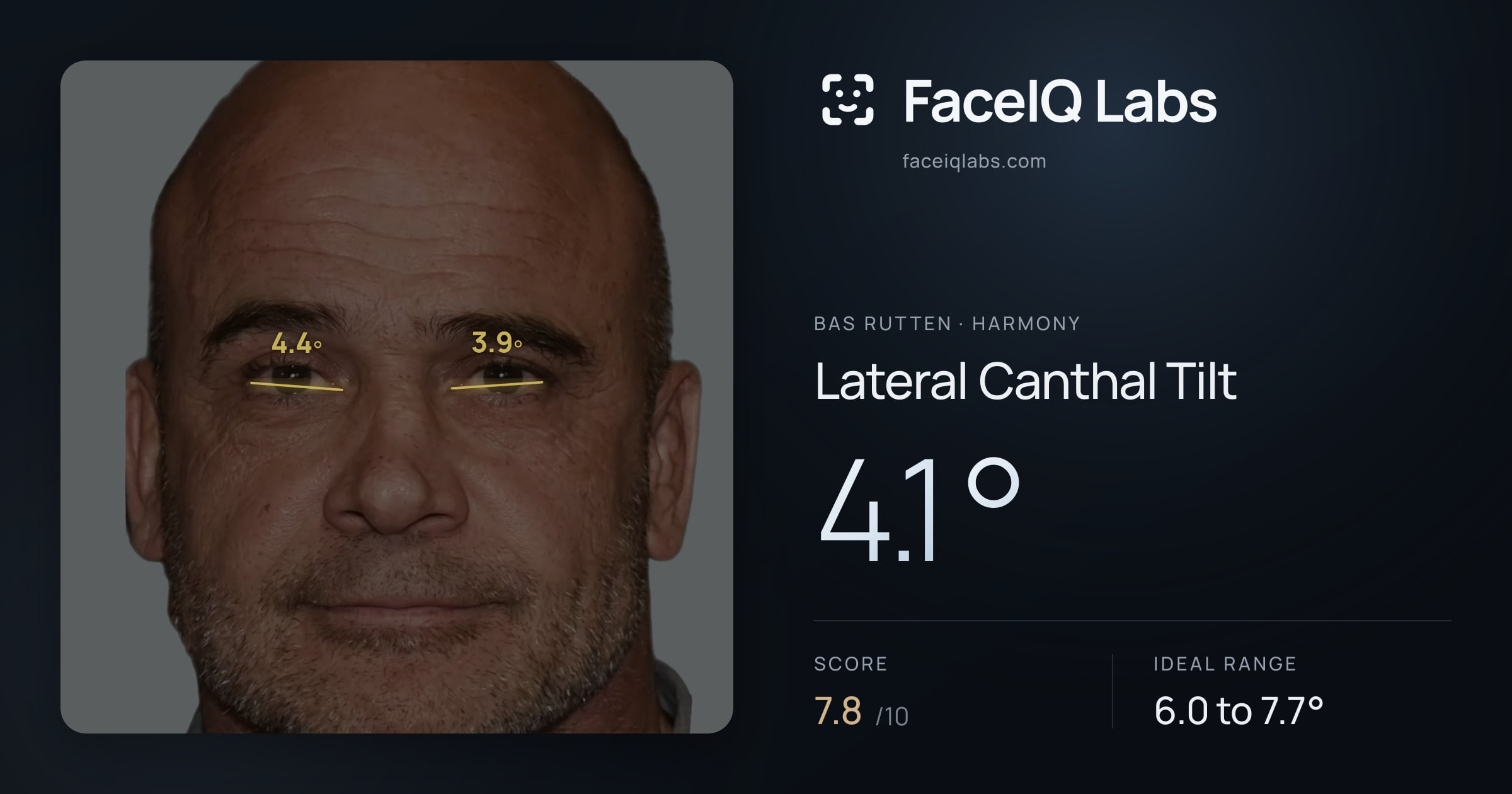 Bas Rutten Lateral Canthal Tilt: 4.1°, drawn on the photo