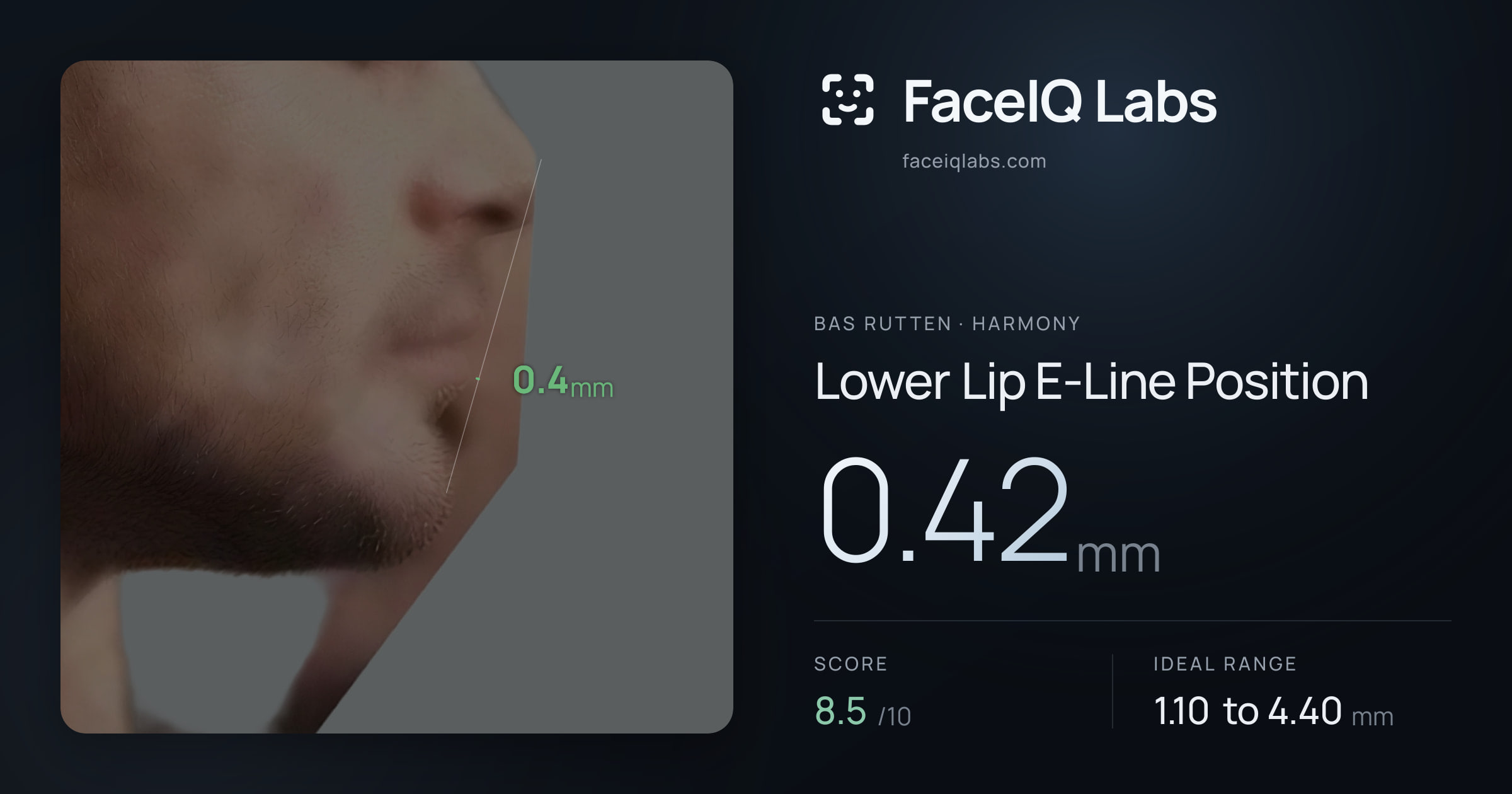 Bas Rutten Lower Lip E-Line Position: 0.42mm, drawn on the photo