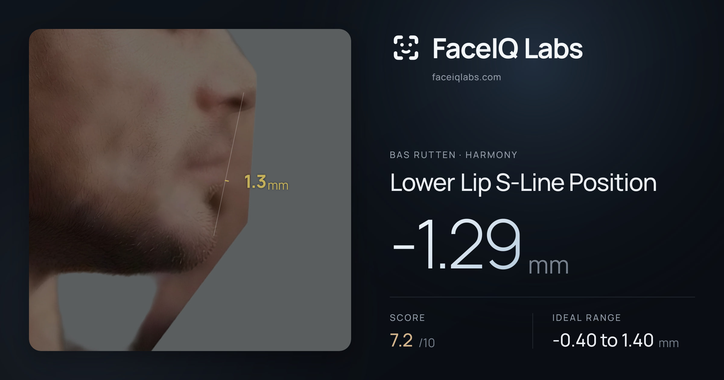 Bas Rutten Lower Lip S-Line Position: -1.29mm, drawn on the photo