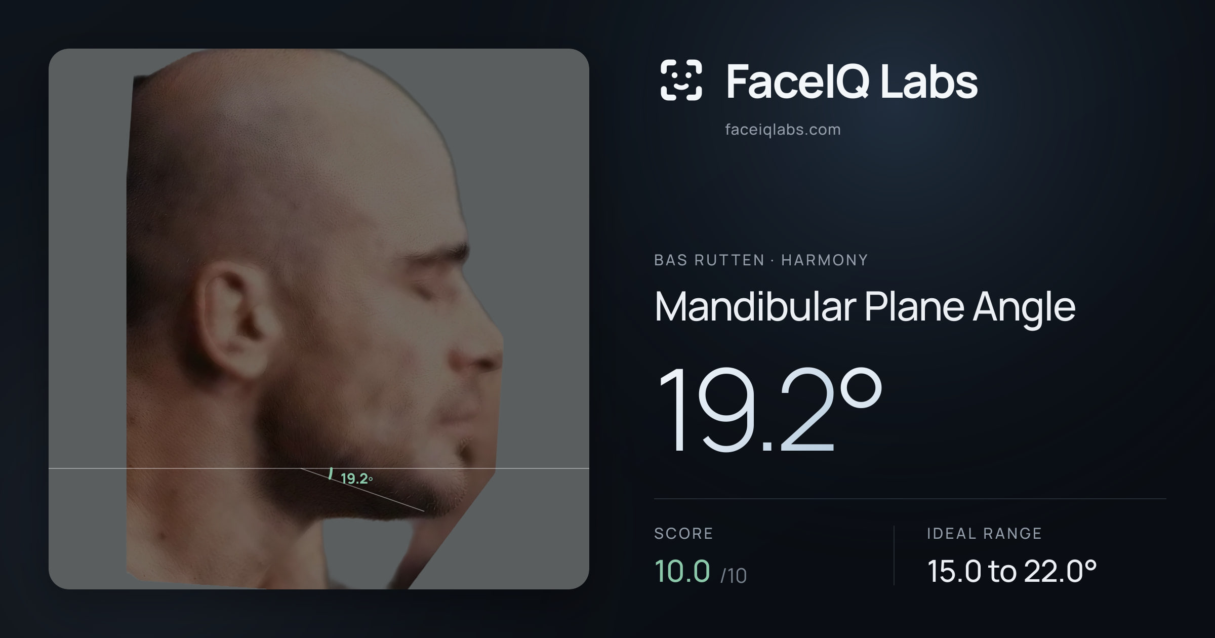 Bas Rutten Mandibular Plane Angle: 19.2°, drawn on the photo