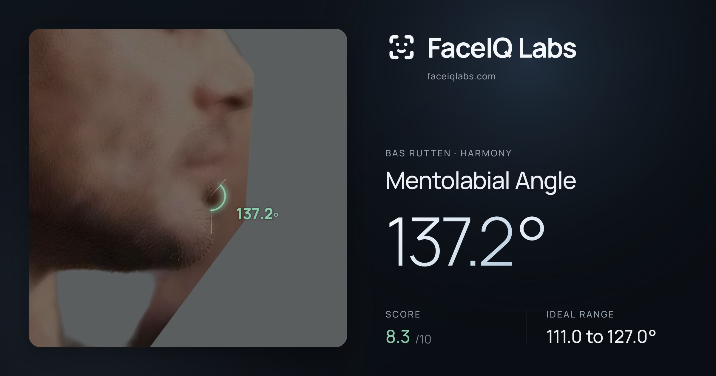 Bas Rutten Mentolabial Angle: 137.2°, drawn on the photo