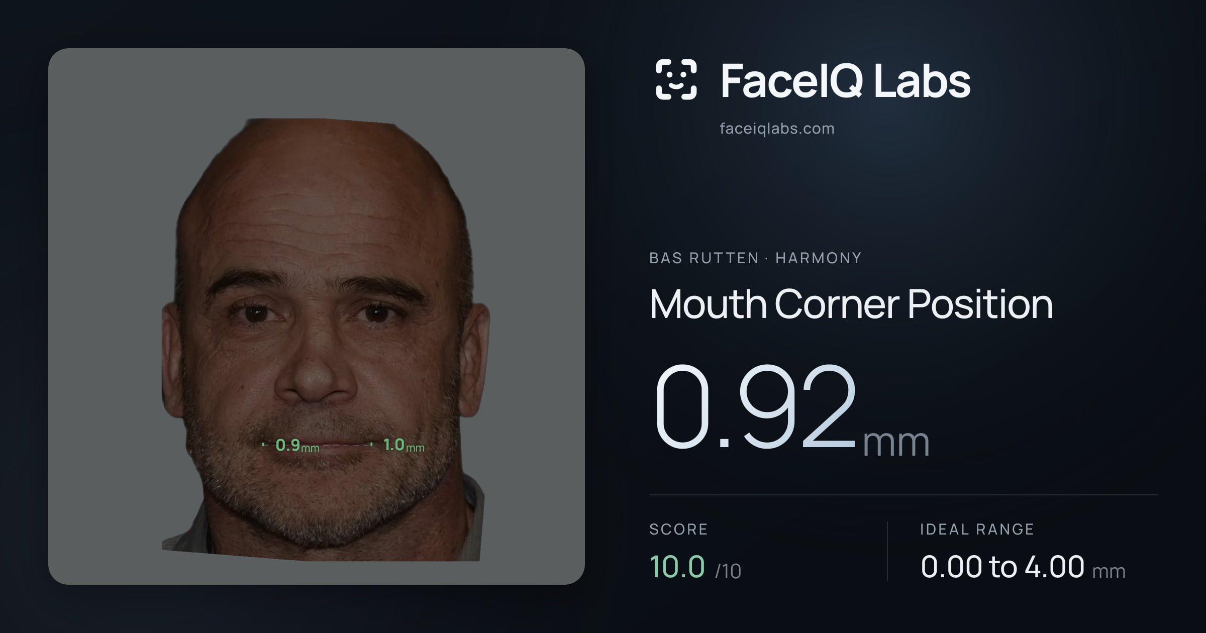 Bas Rutten Mouth Corner Position: 0.92mm, drawn on the photo