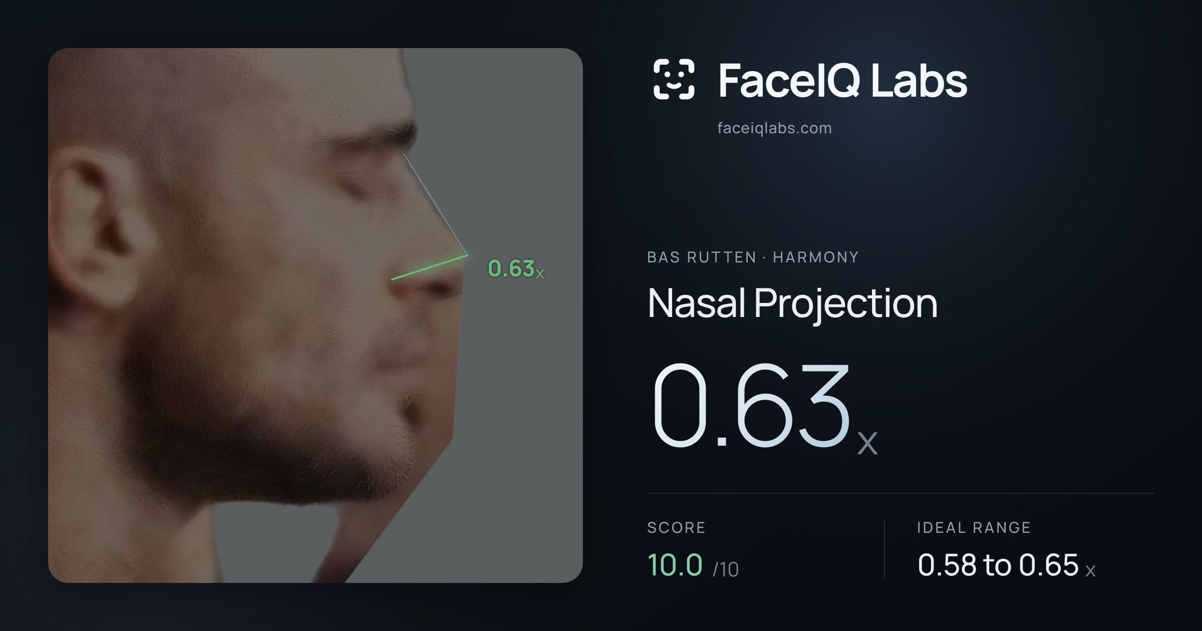 Bas Rutten Nasal Projection: 0.63x, drawn on the photo