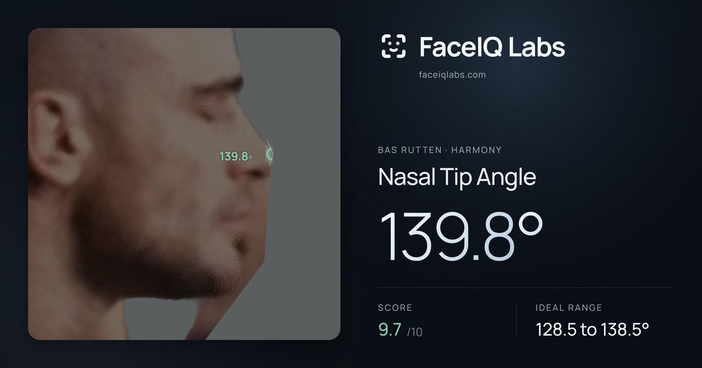 Bas Rutten Nasal Tip Angle: 139.8°, drawn on the photo