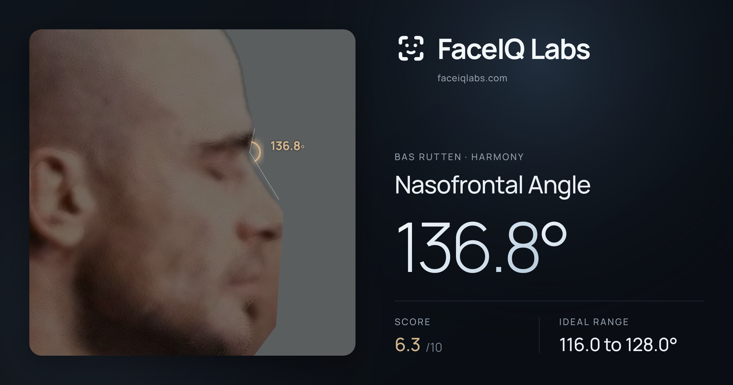 Bas Rutten Nasofrontal Angle: 136.8°, drawn on the photo
