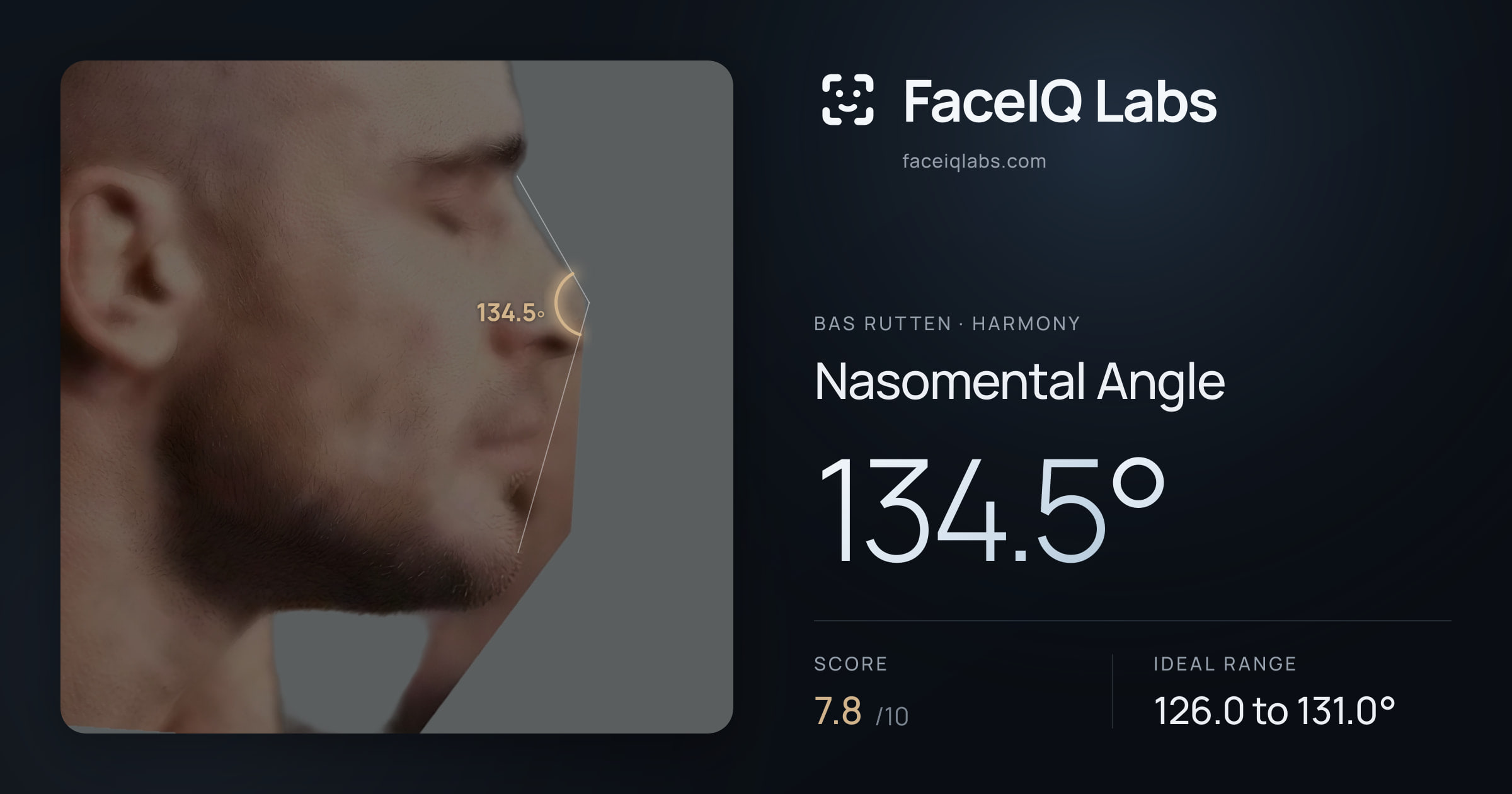 Bas Rutten Nasomental Angle: 134.5°, drawn on the photo