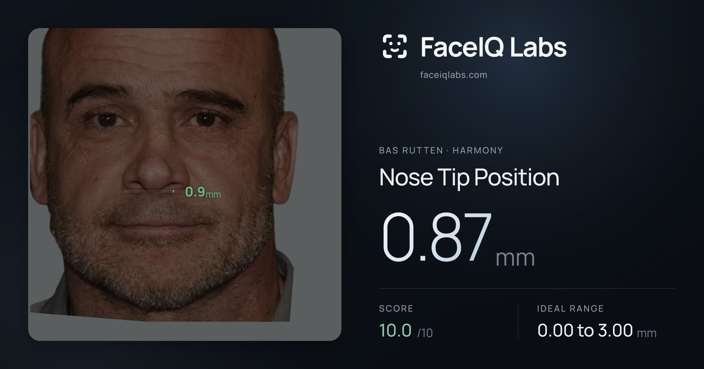 Bas Rutten Nose Tip Position: 0.87mm, drawn on the photo