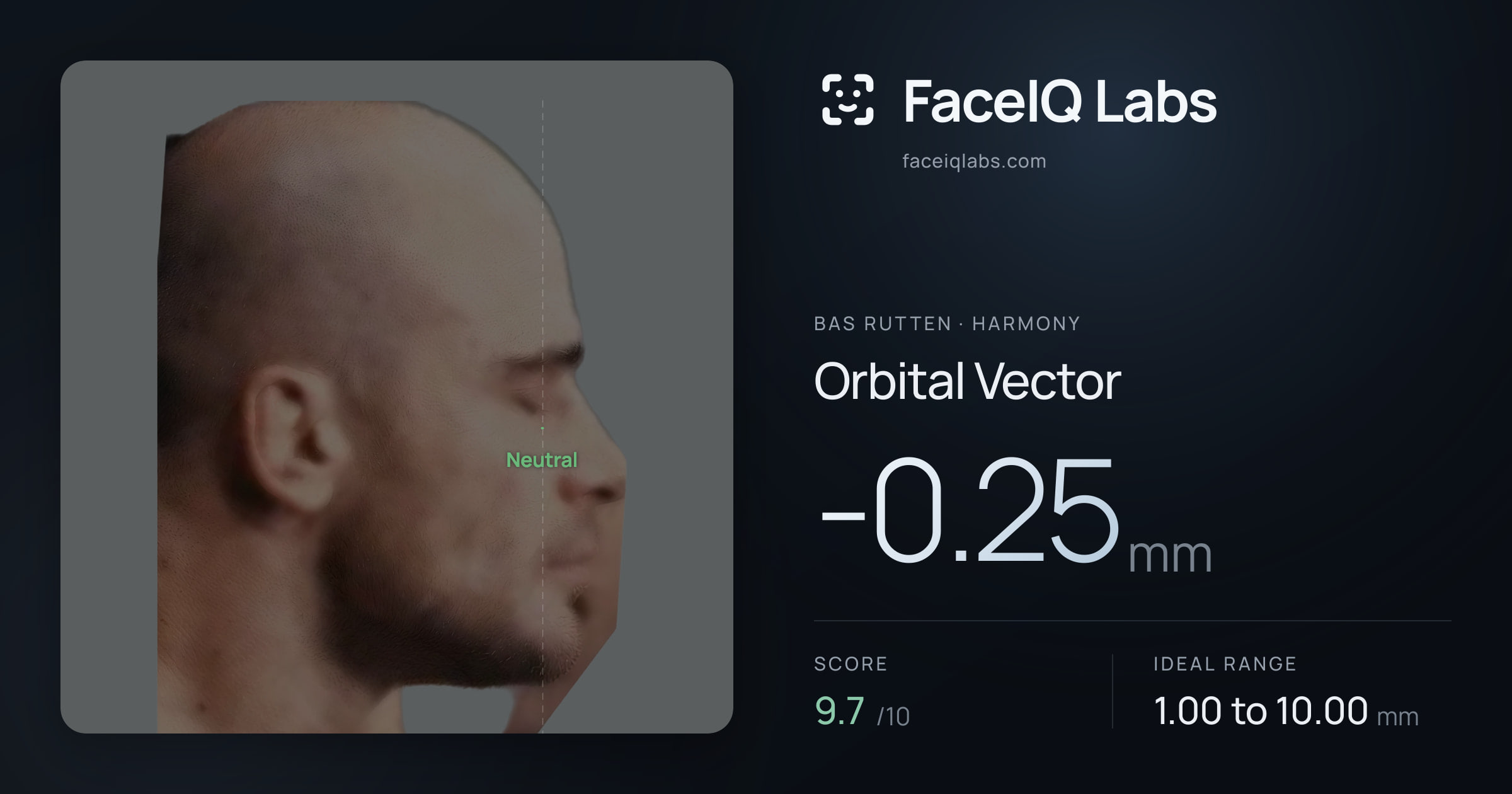 Bas Rutten Orbital Vector: -0.25mm, drawn on the photo
