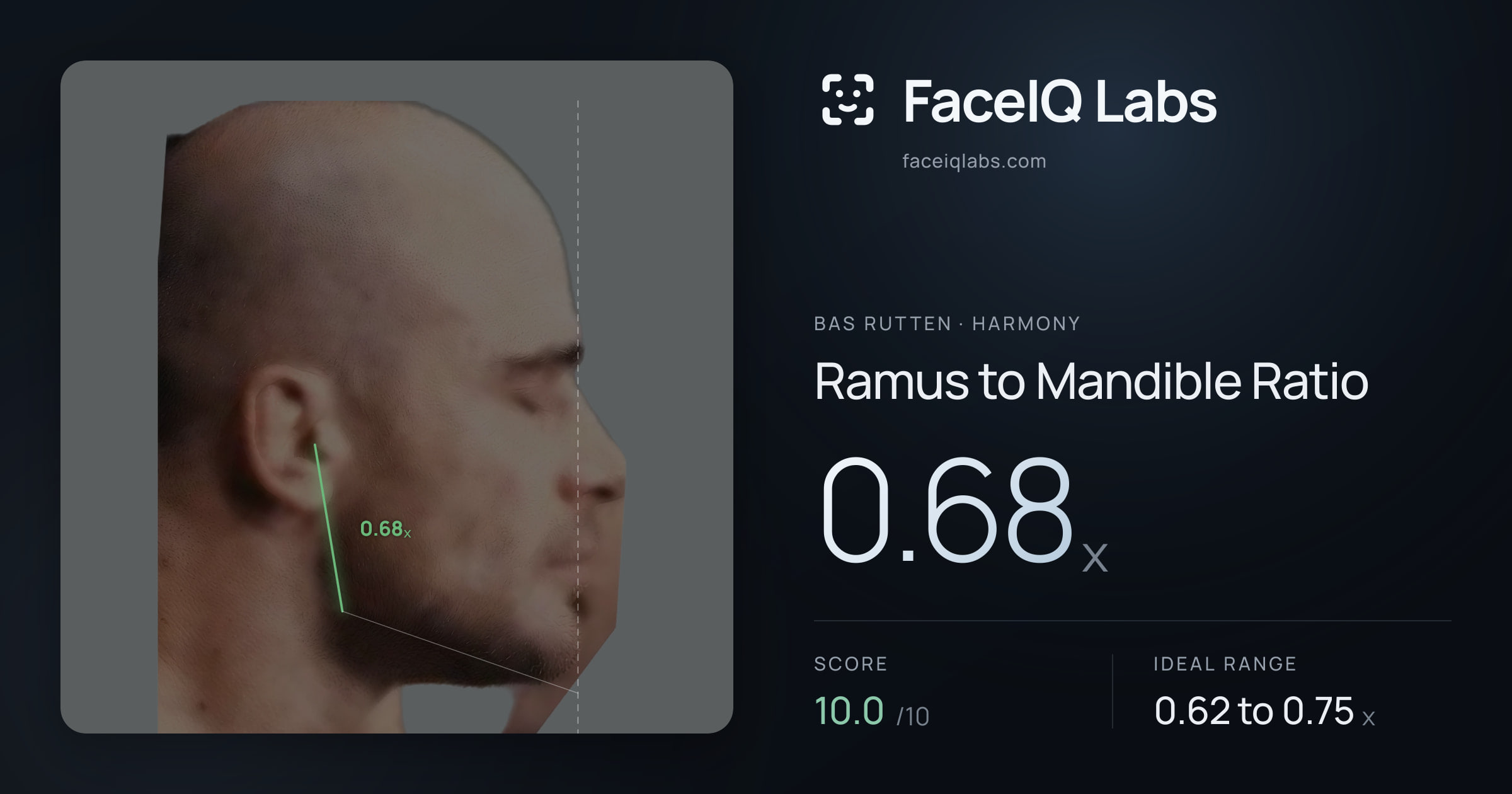 Bas Rutten Ramus to Mandible Ratio: 0.68x, drawn on the photo