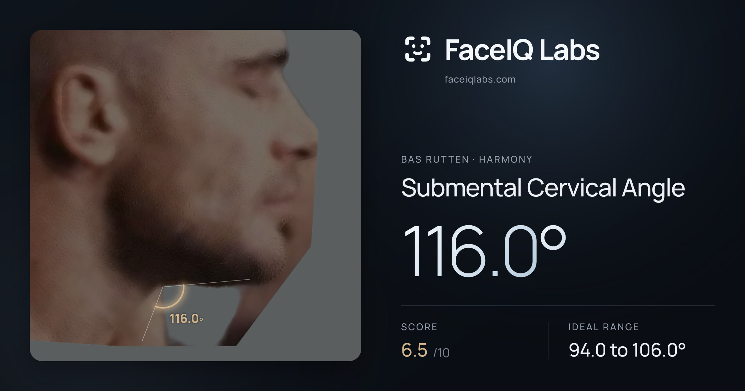 Bas Rutten Submental Cervical Angle: 116.0°, drawn on the photo