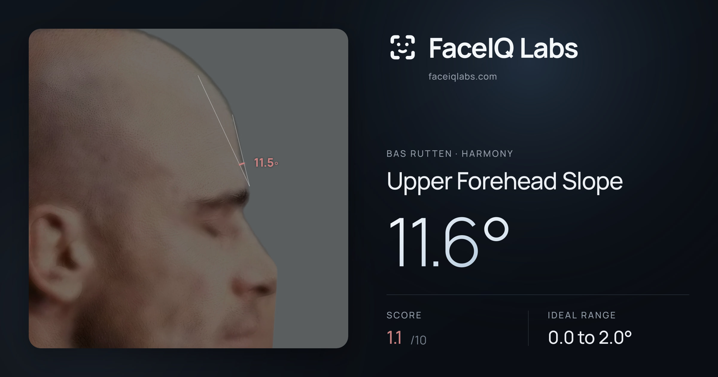 Bas Rutten Upper Forehead Slope: 11.6°, drawn on the photo