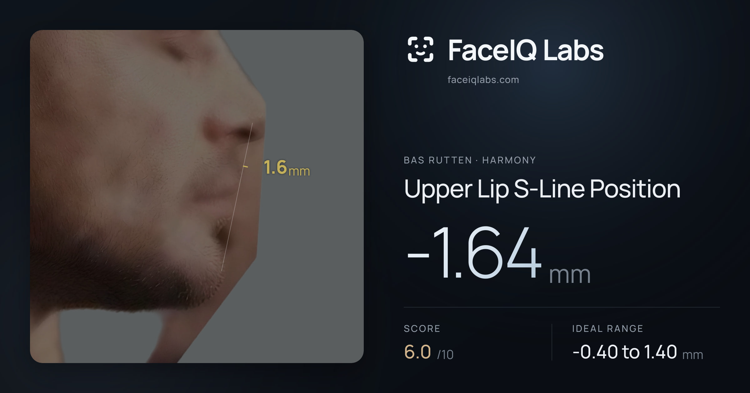 Bas Rutten Upper Lip S-Line Position: -1.64mm, drawn on the photo