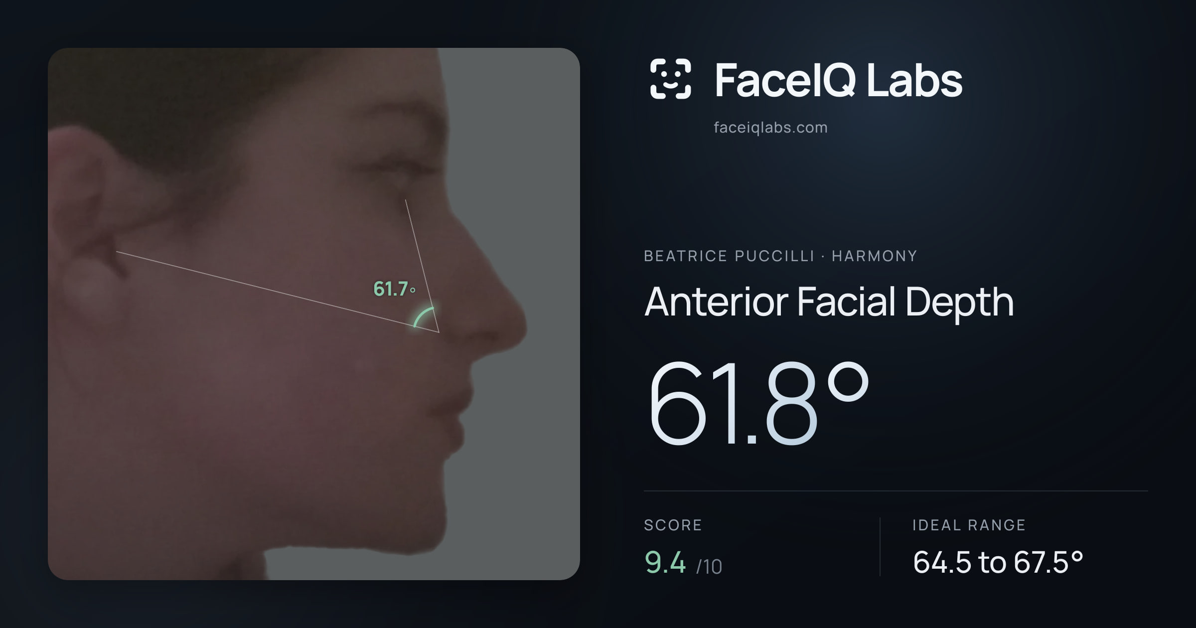 Beatrice Puccilli Anterior Facial Depth: 61.8°, drawn on the photo