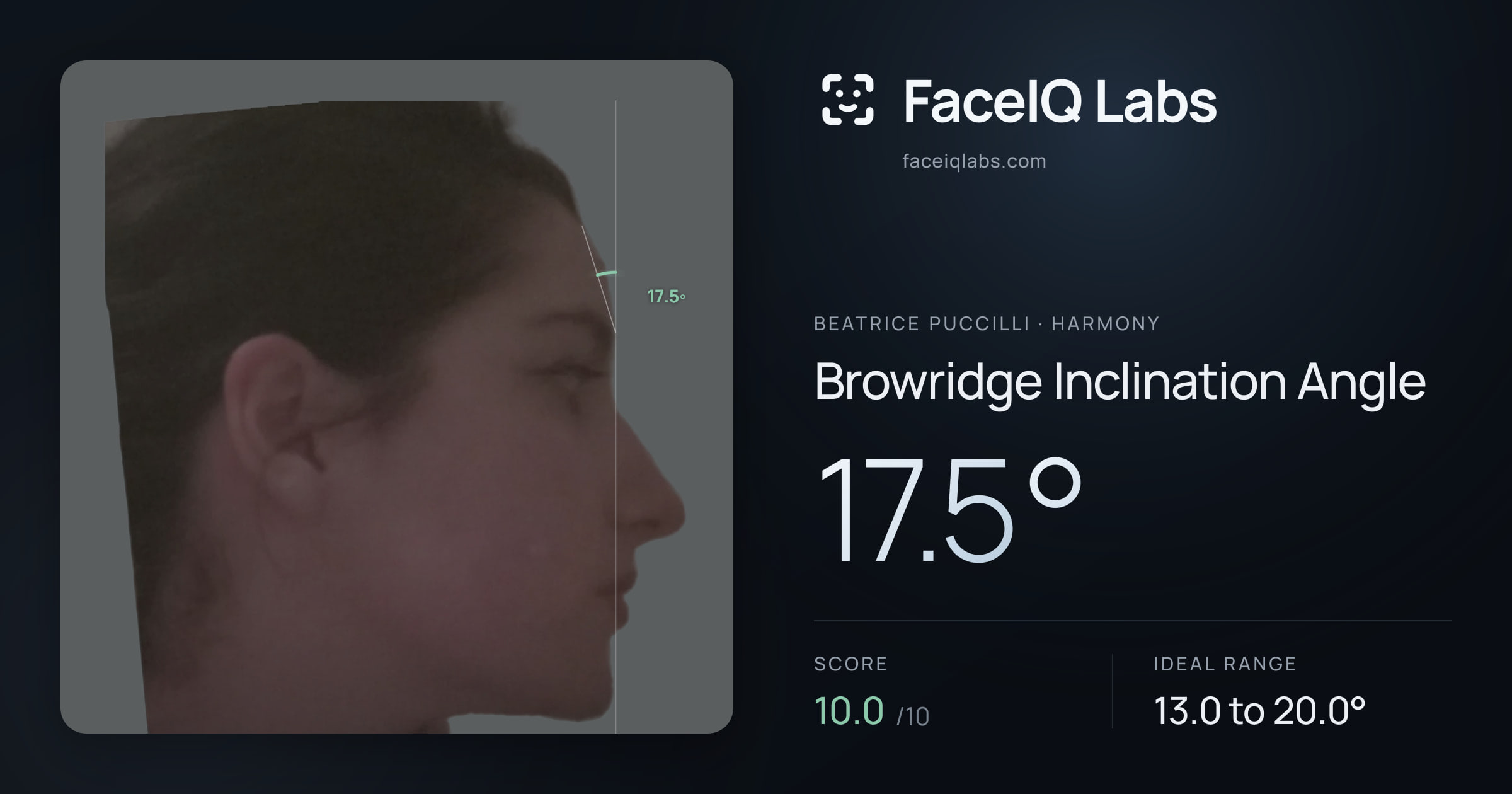 Beatrice Puccilli Browridge Inclination Angle: 17.5°, drawn on the photo