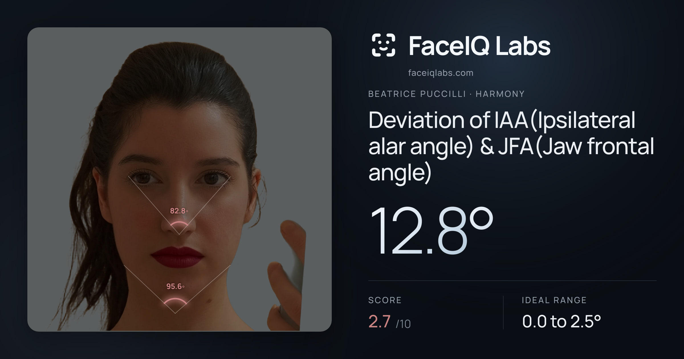 Beatrice Puccilli Deviation of IAA(Ipsilateral alar angle) & JFA(Jaw frontal angle): 12.8°, drawn on the photo